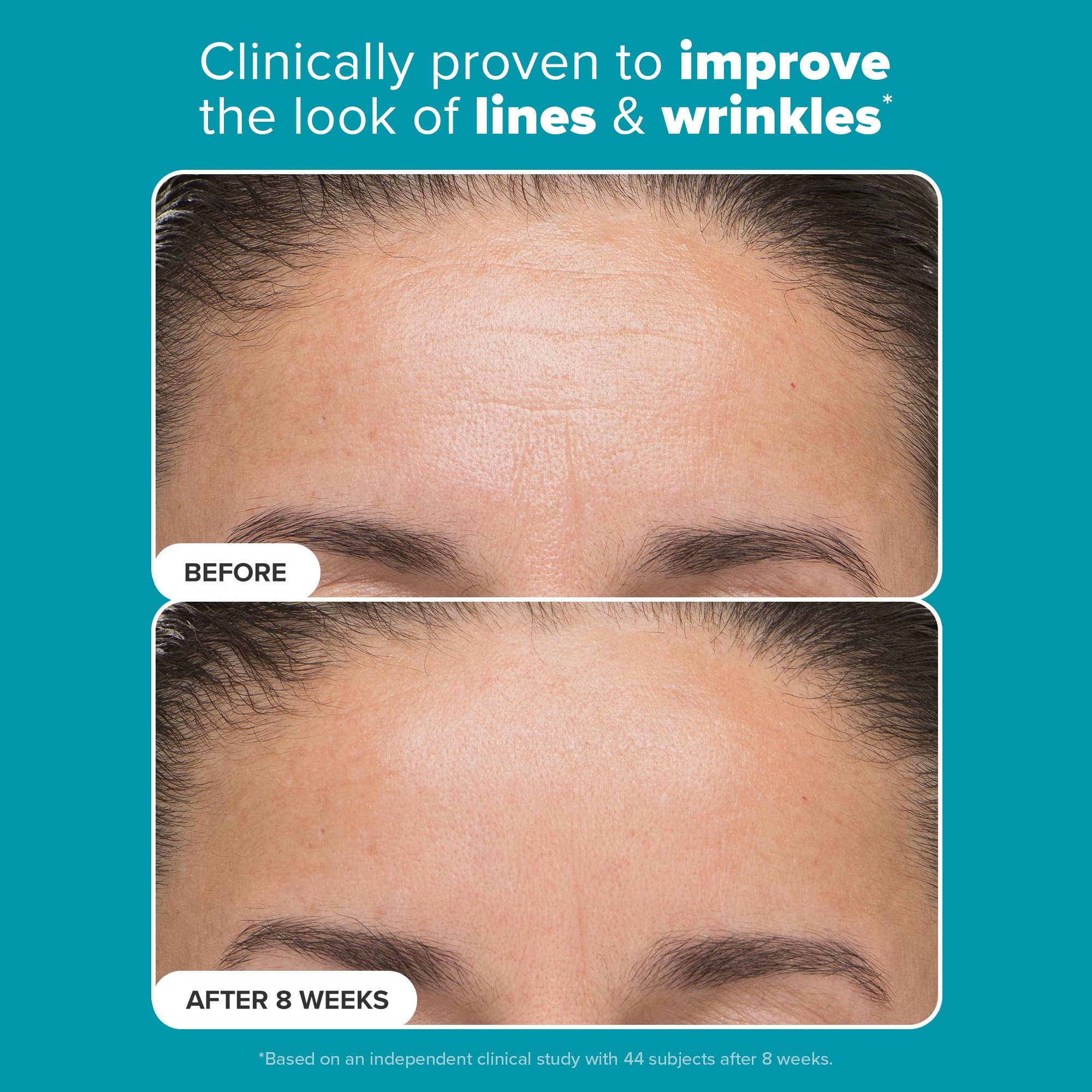 Paula’s Choice 6% Mandelic Acid + 2% Lactic Acid Exfoliant, Gentle Daily AHA Exfoliation for Discoloration, Bumpy Texture & Radiance, for Sensitive Skin, Fragrance-Free & Paraben-Free, 1 Fl. Oz.