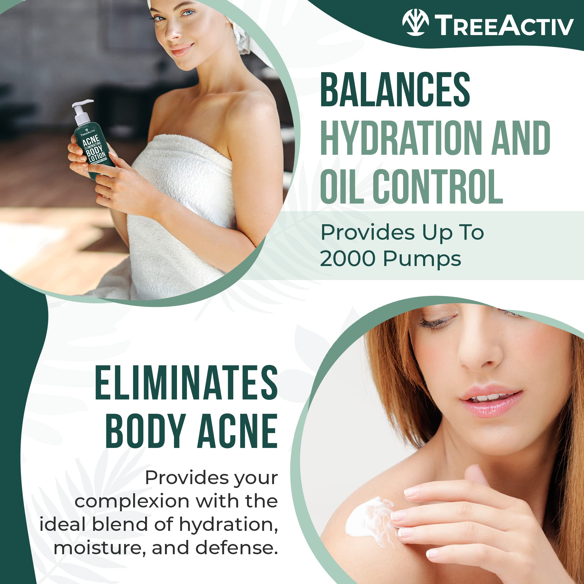 TreeActiv Acne Eliminating Body Lotion 8 fl oz | Clears Body, Back, Butt and Shoulder Acne | Anti-Acne Moisturizer | Prevents Future Breakouts | Cucumber Mint Scent