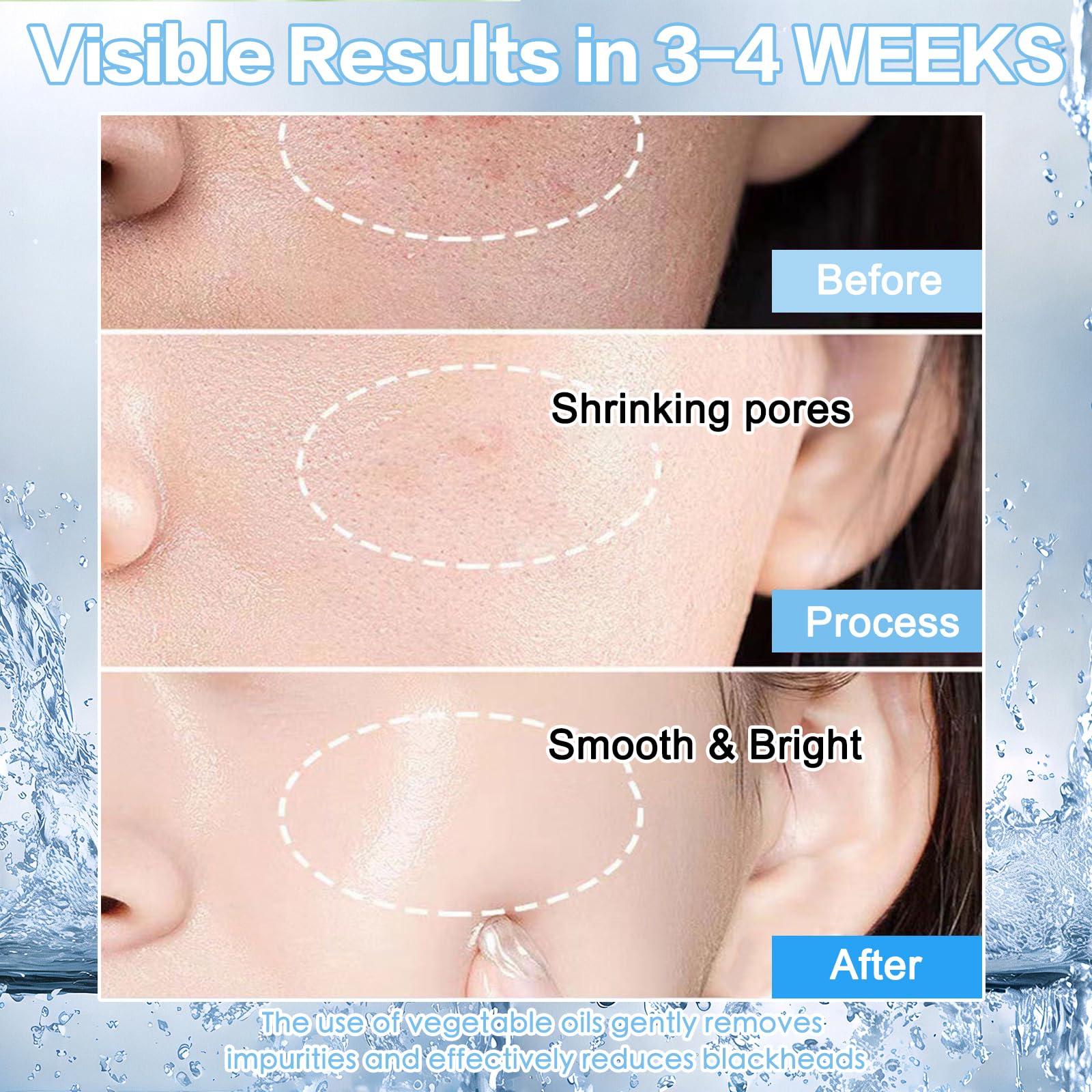 Niacinamide 15% Facial Serum