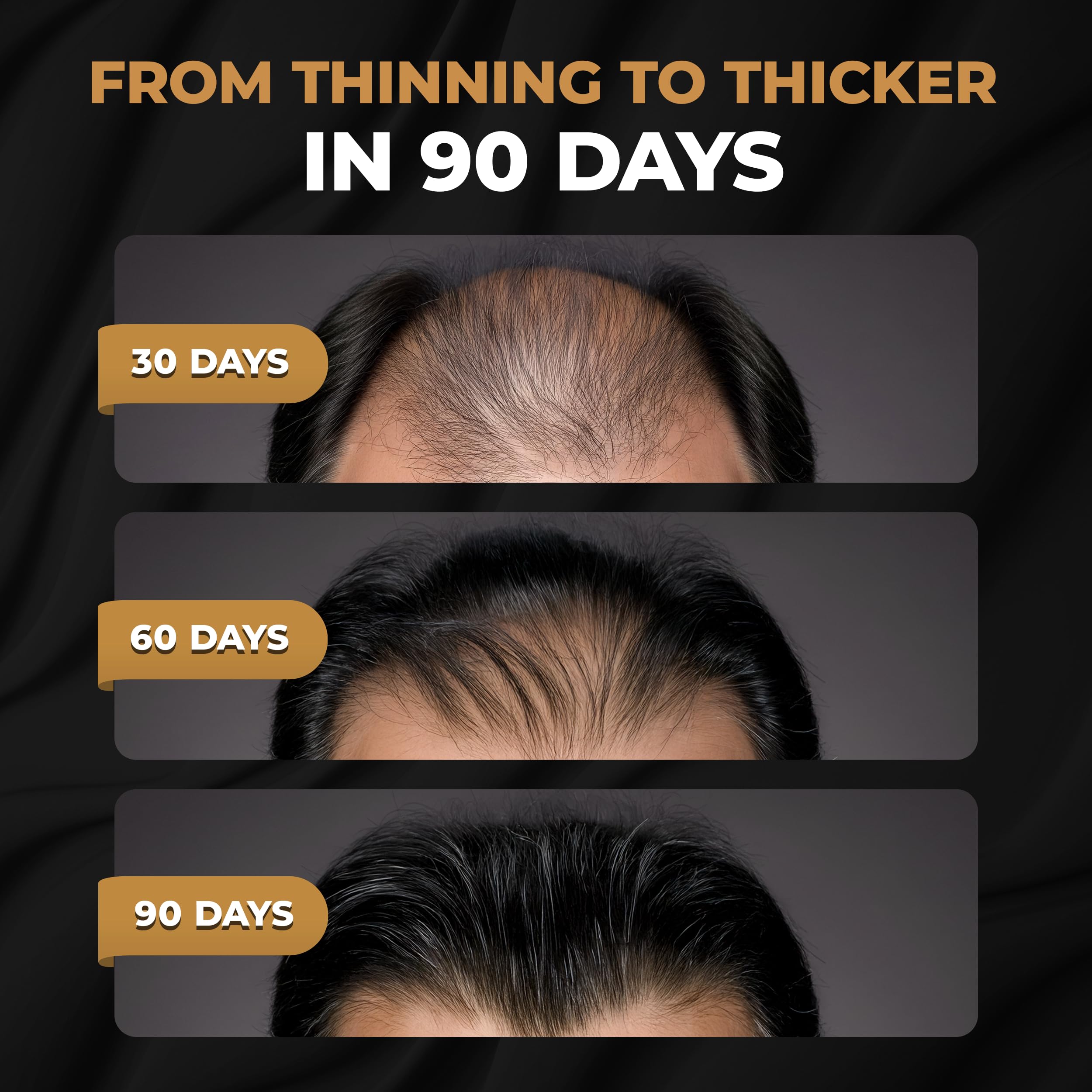 SPARTAN™ Root Activator Shampoo For Men - Hair Growth Shampoo for Hair Loss and Thinning Hair