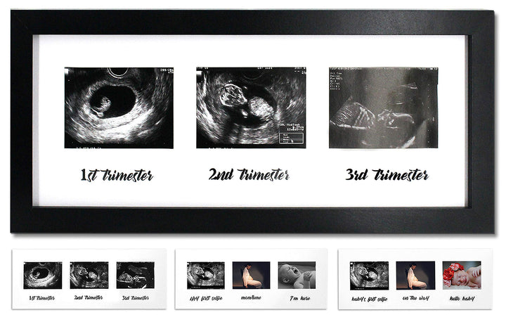 IHEIPYE Triple Sonogram Pregnancy Frame – Baby Ultrasound Picture Frame with Story for Expecting Parents, Baby Shower Frame, Baby Grow Through All Three Trimesters Frame, Nursery Decor, Black