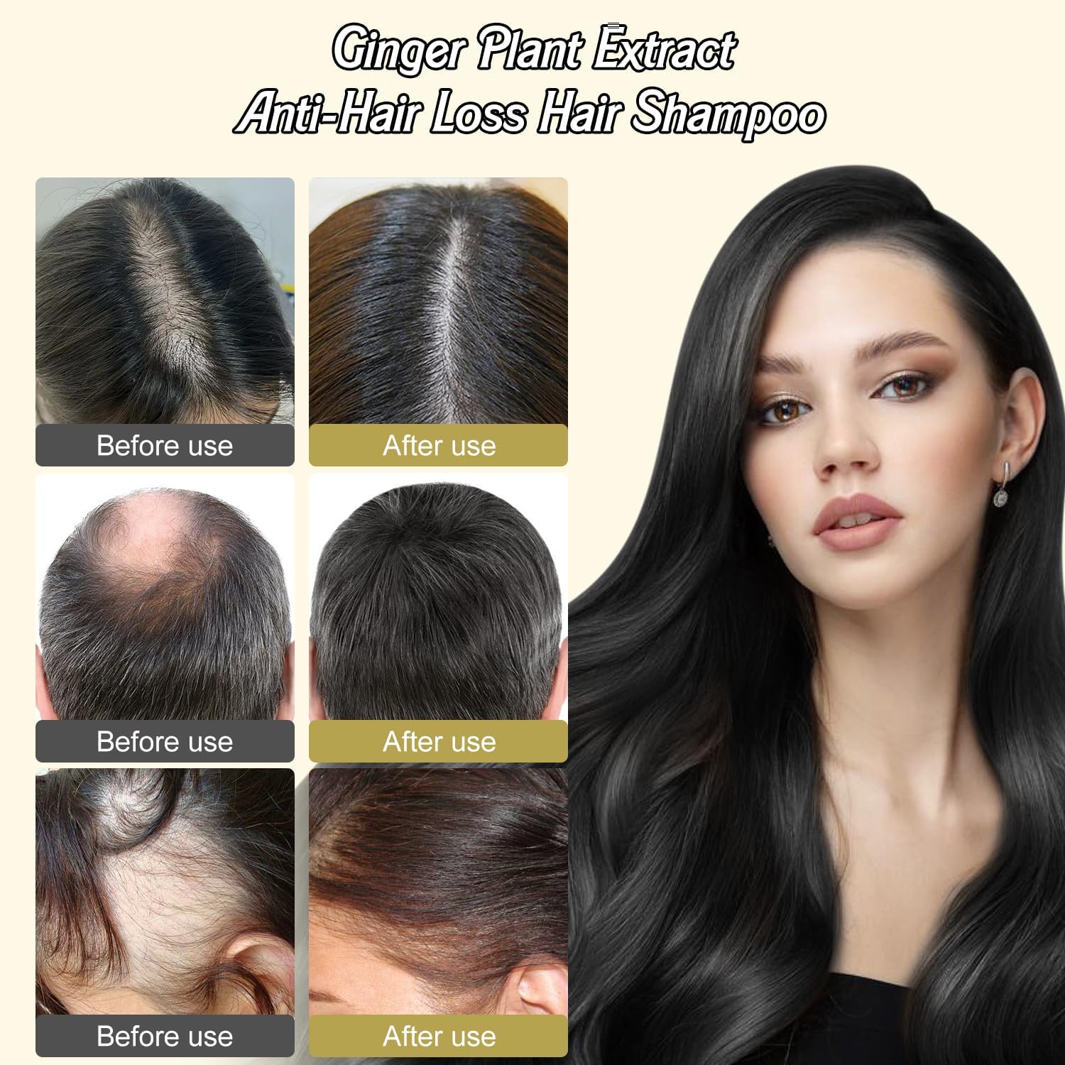 YCNASSS Ginger Plant Extract Shampoo for Hair Growth, Anti-Dandruff and Oil Control with Polygonum Multiflorum