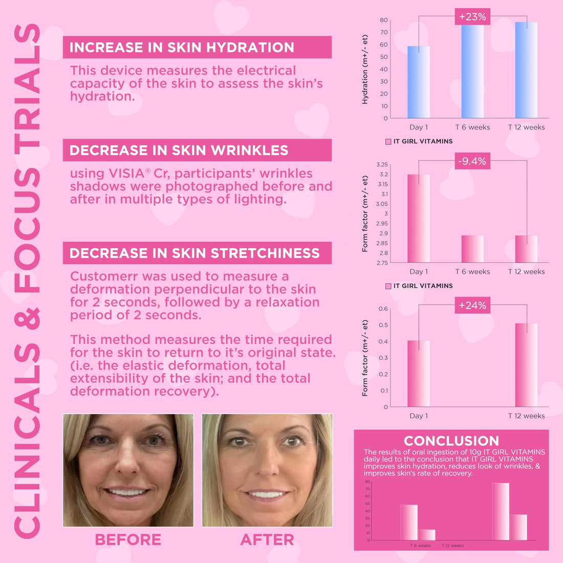 Multi Collagen Peptides Gummies for Women, Vegan Skin Supplement - Retinol, Hyaluronic Acid, Sea Moss, Vitamin C & Antioxidants for Anti-Aging, Hydration, Glow, Acne, Spots, Edible Korean Skin Care