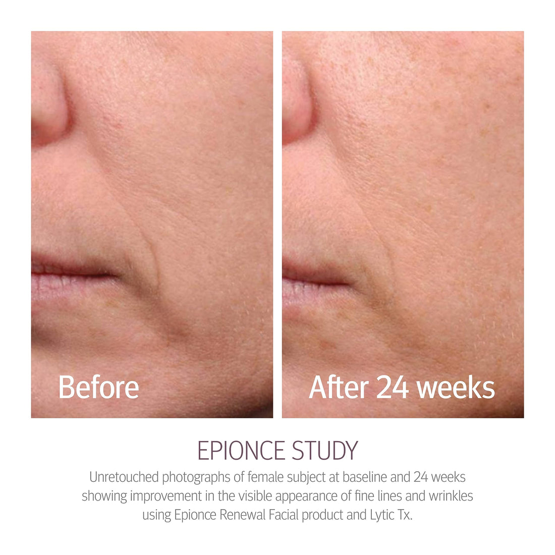 Epionce Renewal Lite Facial Lotion 1.7 Oz