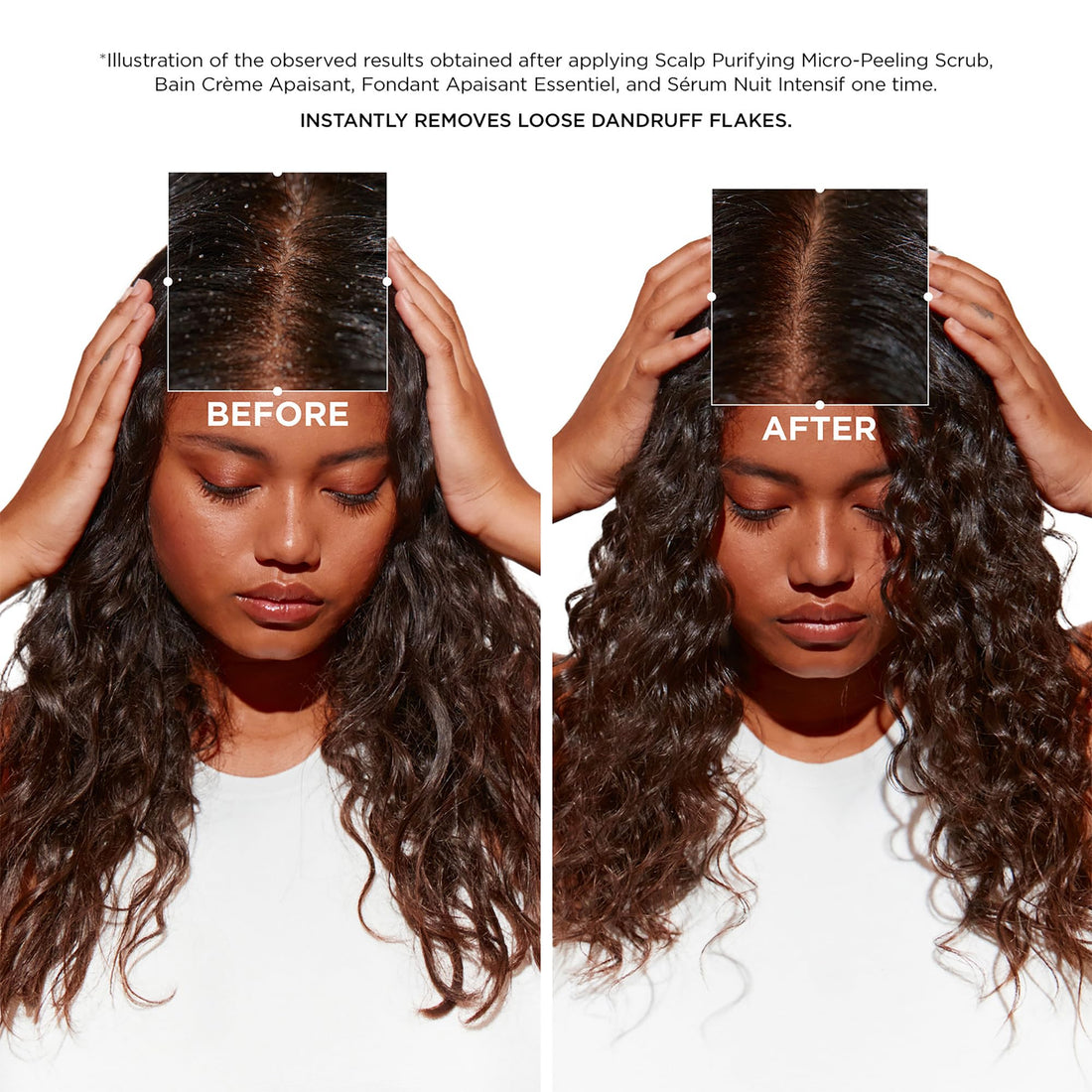 KÉRASTASE Symbiose Soothing Conditioner, Apaisant Essentiel for Sensitive Scalp & Dandruff-Prone Hair, Soothes & Hydrates Dry Hair & Scalp, Silicone-Free, 6.8 Fl Oz