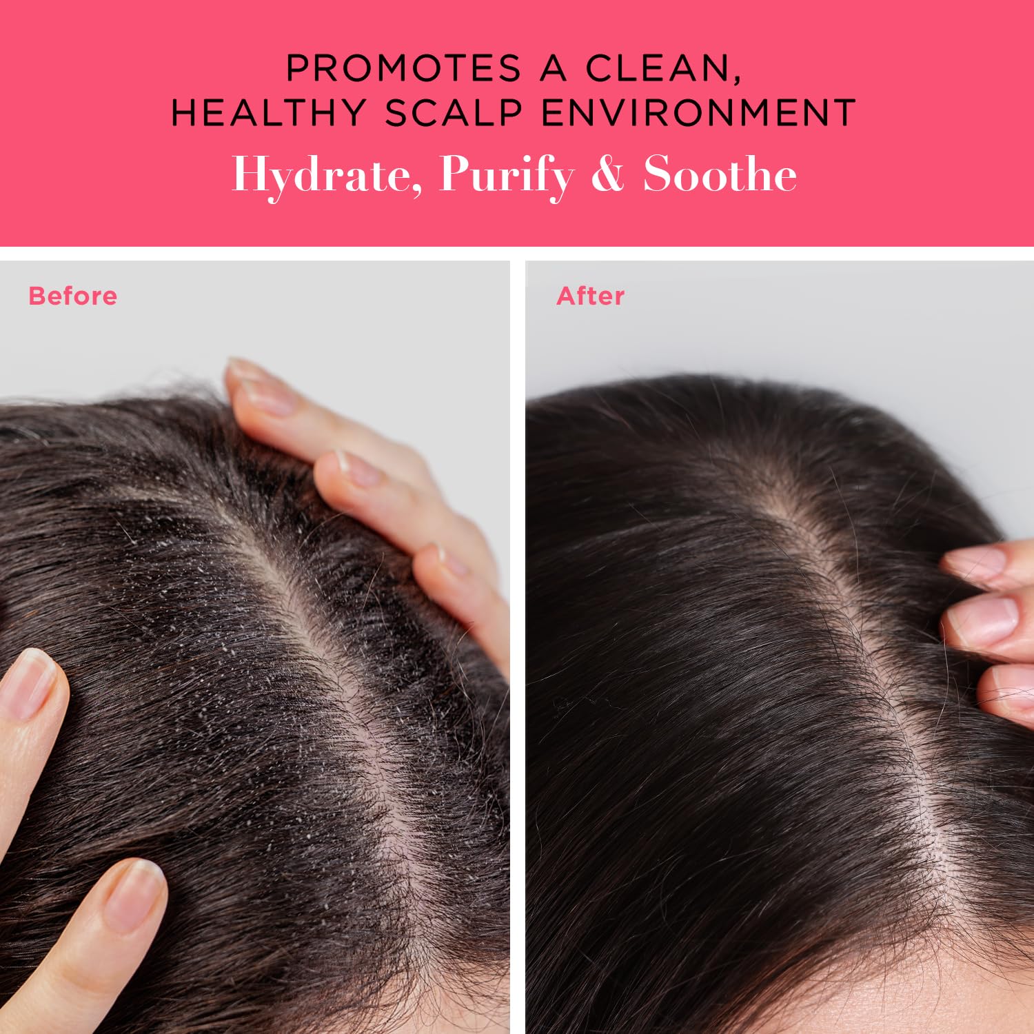 Unwash Balancing Scalp Serum for Unisex - 2.5 oz Serum