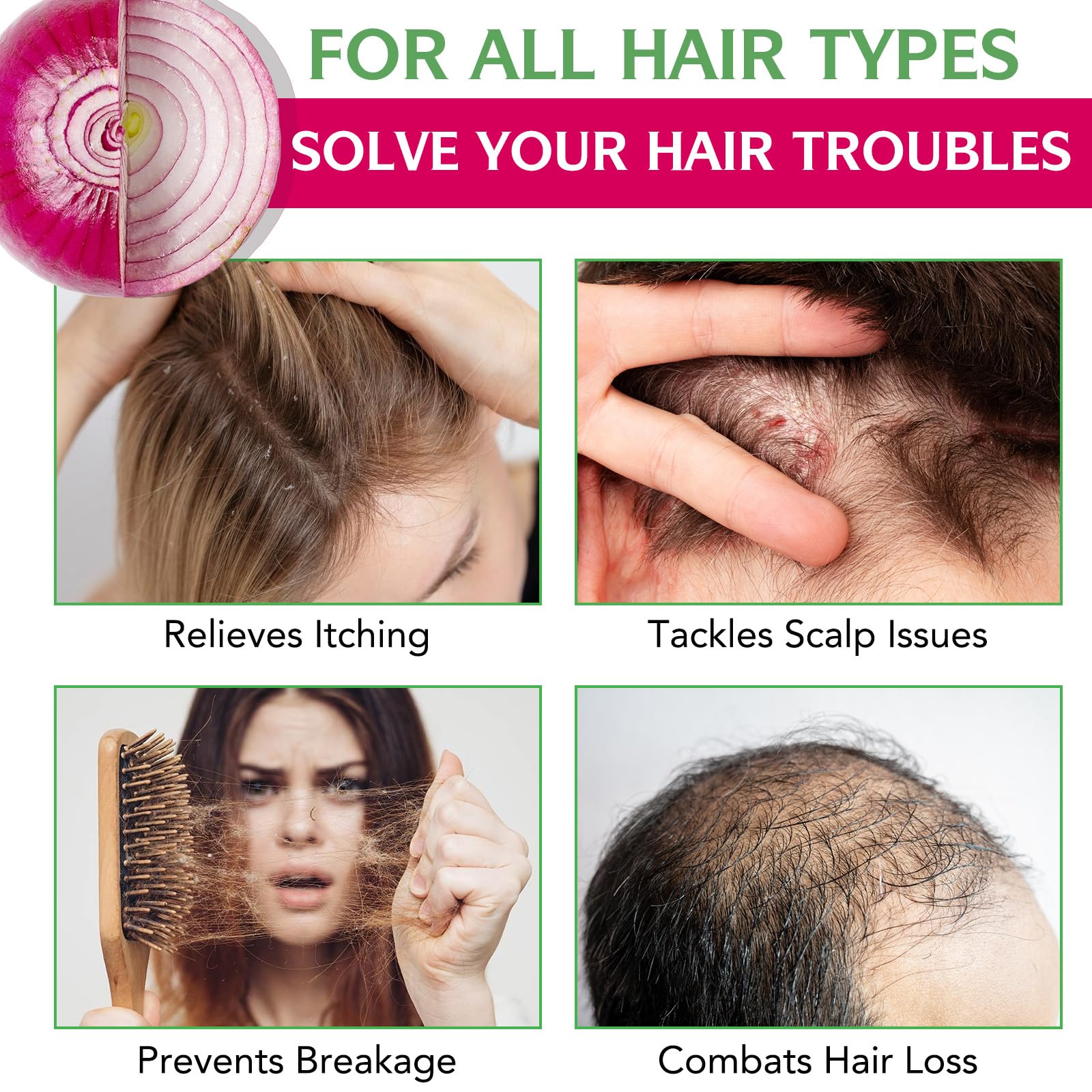 Onion Biotin and Rosemary Shampoo and conditioner Treatment Set, All Hair Types Conditioner Hair Care, Thinning Hair, Reduce Hair Loss -Soft and Shine - Promotes Growth for Fuller Healthier