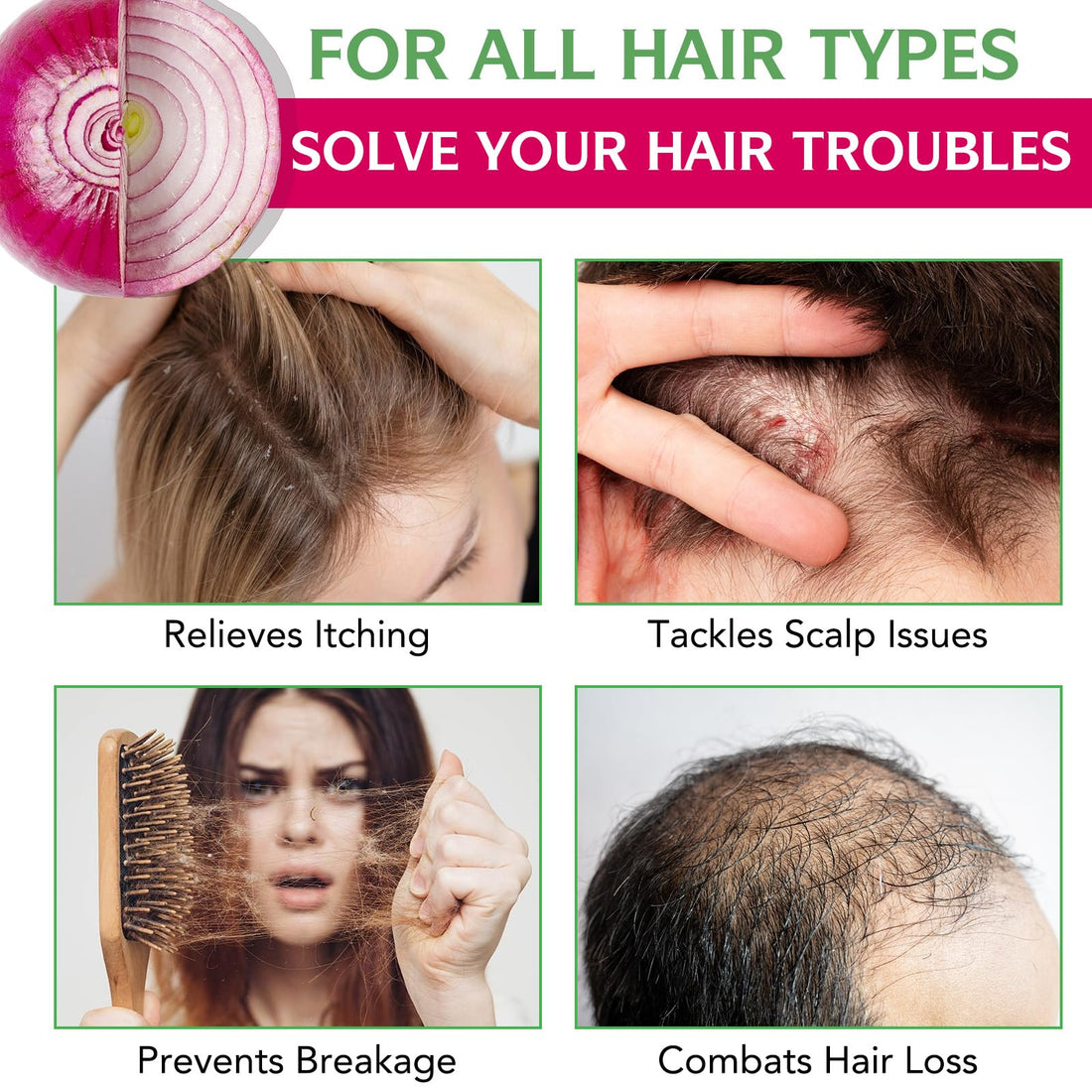 Onion Biotin and Rosemary Shampoo and conditioner Treatment Set, All Hair Types Conditioner Hair Care, Thinning Hair, Reduce Hair Loss -Soft and Shine - Promotes Growth for Fuller Healthier