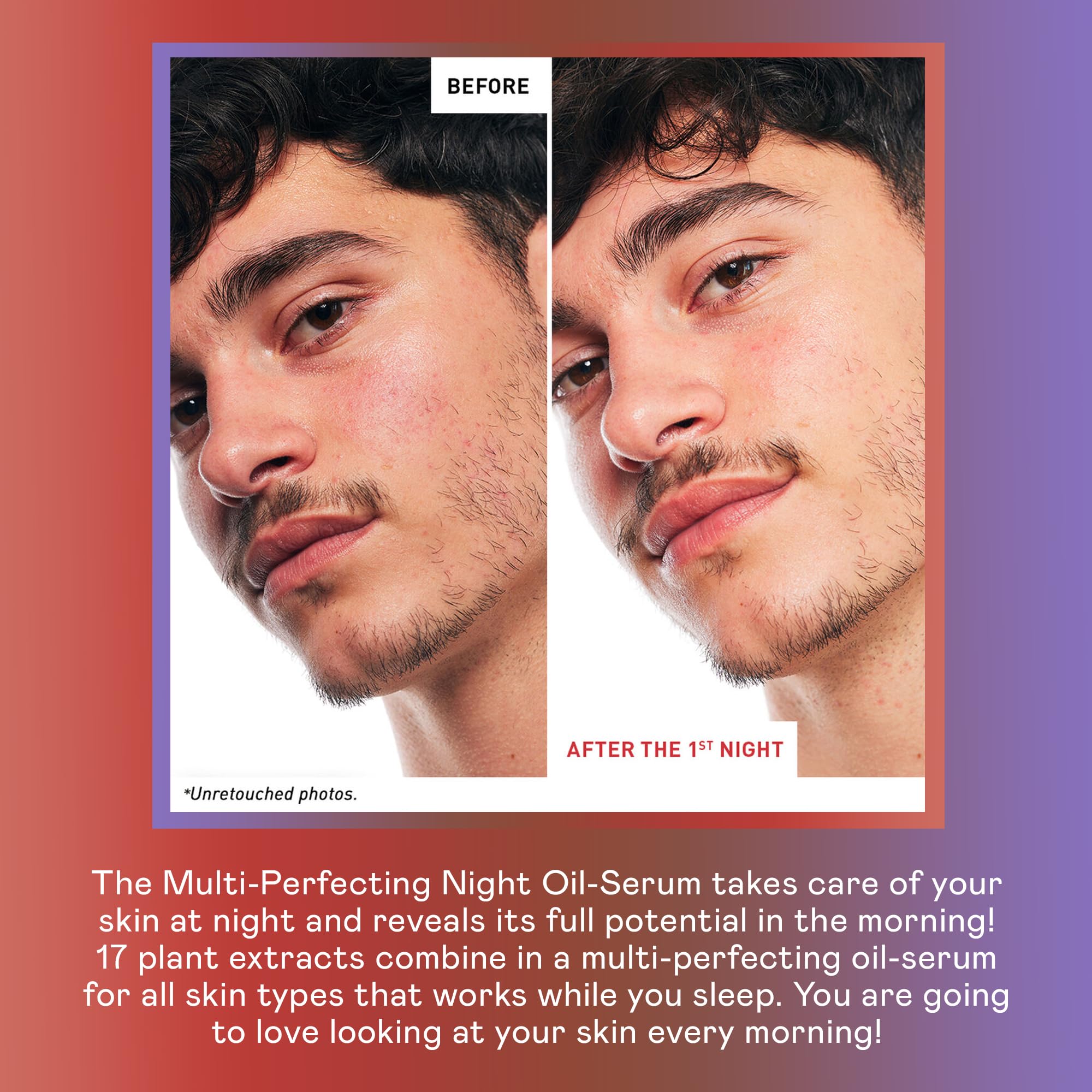 Skin Therapy Multi-Perfecting Bi-Phase Night Oil-Serum - Supercharged With 17 Ingredients -Targets 7 Skin Concerns - Improves Appearance of Fine Lines, Skin Texture and Complexion Evenness (1 Fl Oz)