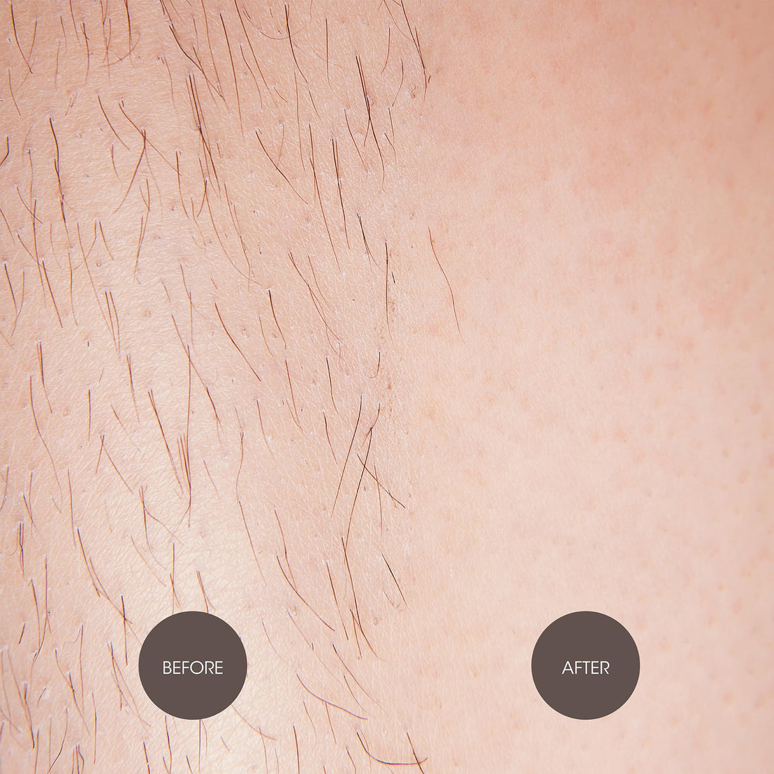 Nad's Wax Hair Removal For Women - Body+Face Wax - All Skin Types - At Home Waxing Kit With 6 Oz Sugar Wax, Cleansing Soap, Wooden Spatula, Re-Usable Cotton Strips