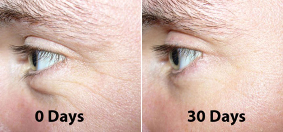 Magic Night Serum-No Needle Alternative-Pure Argireline Peptides Overnight Firming Serum-Argireline, Matrixyl 3000, SNAP-8, Pentapeptide-18 (Leuphasyl), SYN-AKE, Copper Peptide,Syn-Coll, Syn-Tacks