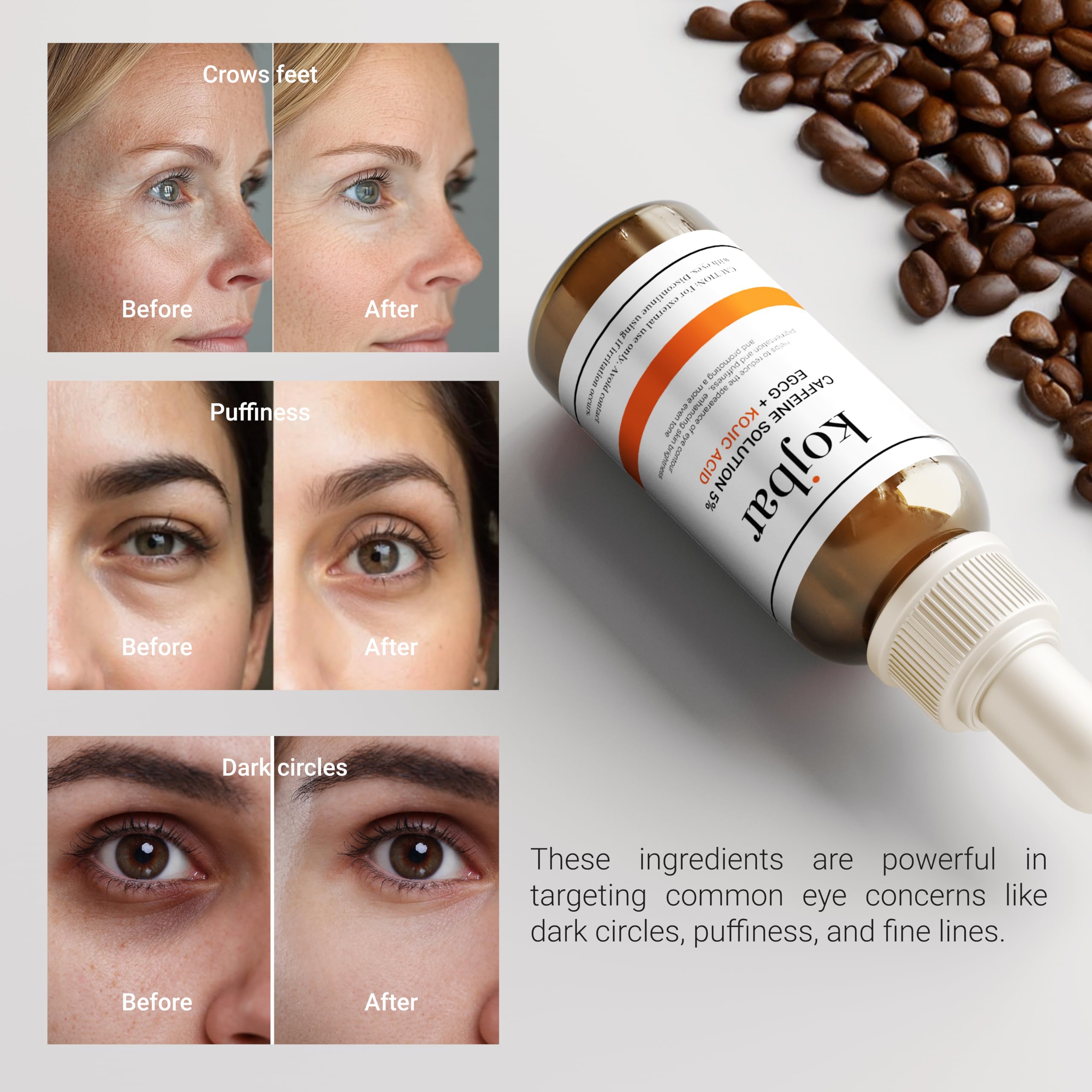 Kojbar Caffeine Solution 5% + EGCG & Kojic Acid Eye Serum – Energizing Eye Treatment for Puffiness & Dark Circles, 1.01 fl oz