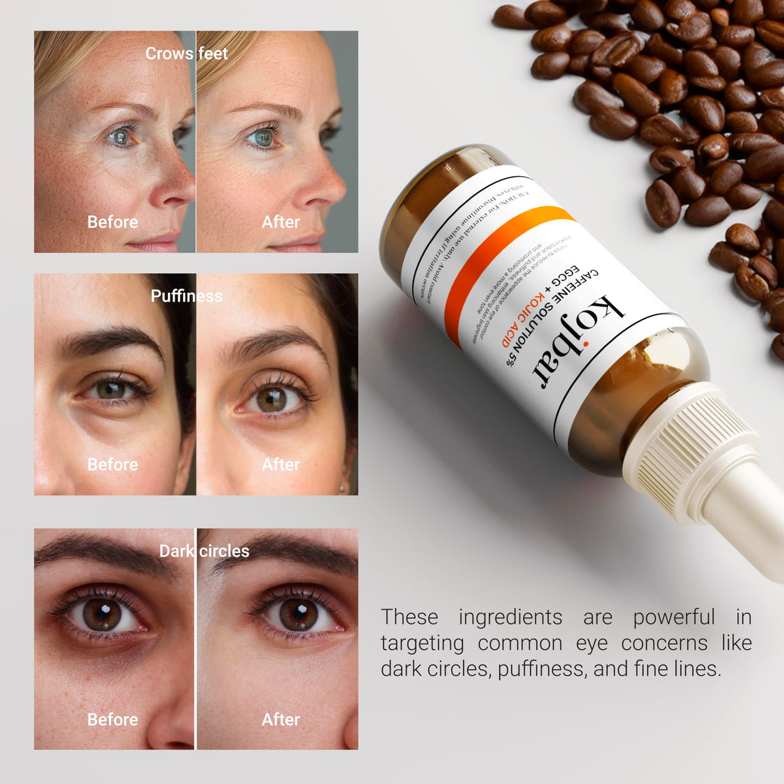 Kojbar Caffeine Solution 5% + EGCG & Kojic Acid Eye Serum – Energizing Eye Treatment for Puffiness & Dark Circles, 1.01 fl oz