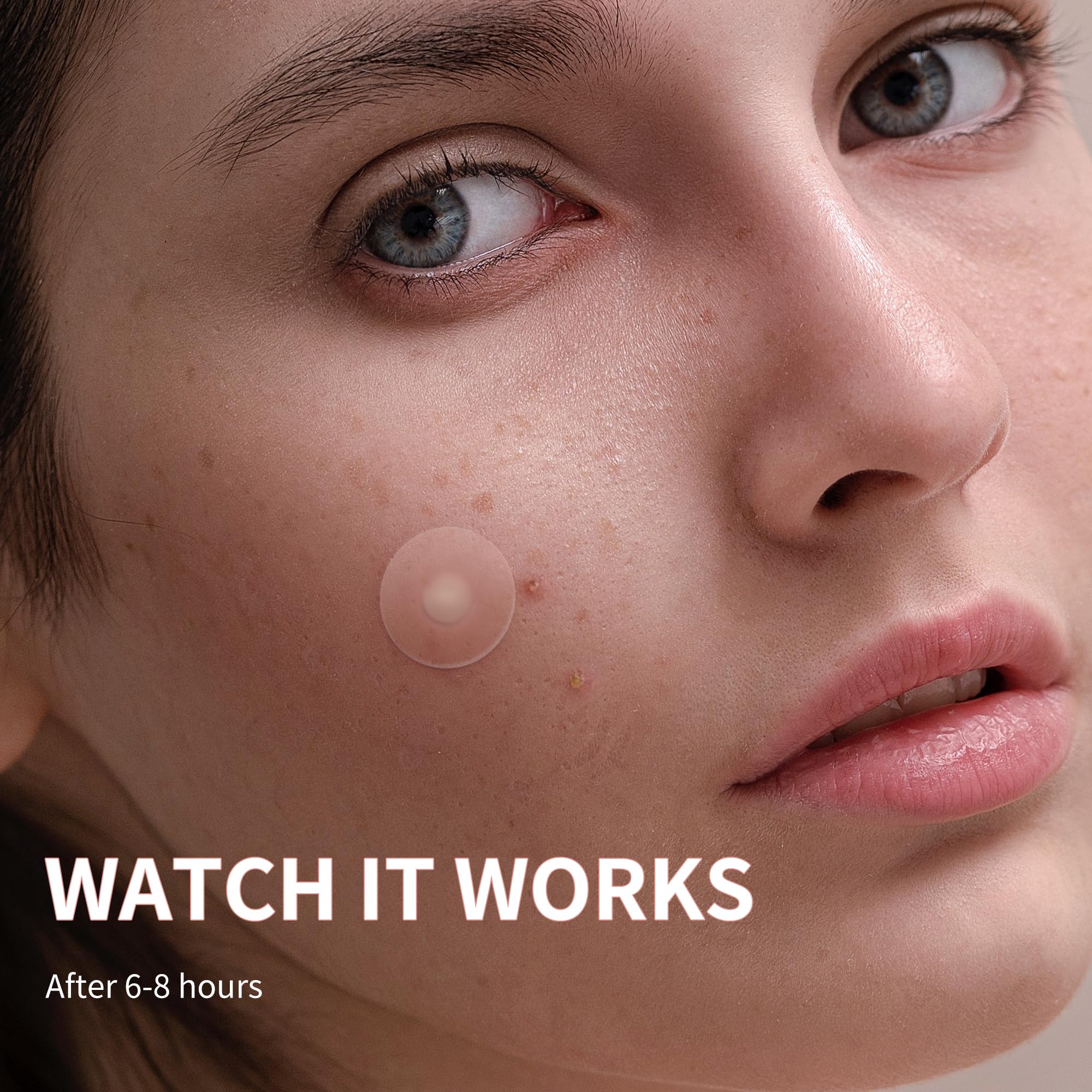 Daolyo Pimple Patches for Face, 3 Size 510 Counts Hydrocolloid Acne Patches for Covering Zits and Blemishes, Spot Stickers with Salicylic Acid, Tea Tree Oil & Calendula Oil(8mm,10mm,12mm)