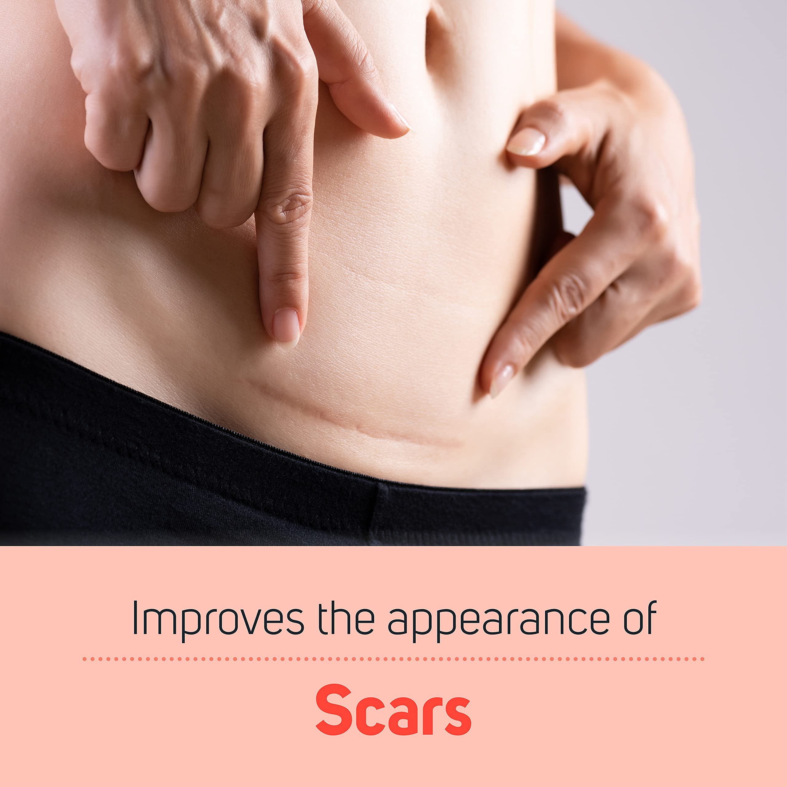 Care Science Stretch Marks + Scars Skin Care Body Oil, 5 OZ | For C Section Recovery, Scars, Stretch Marks, Hair, Aging, Dehydrated Skin | Natural Ingredients, Vitamin E Oil, Olive Oil, Coconut Oil