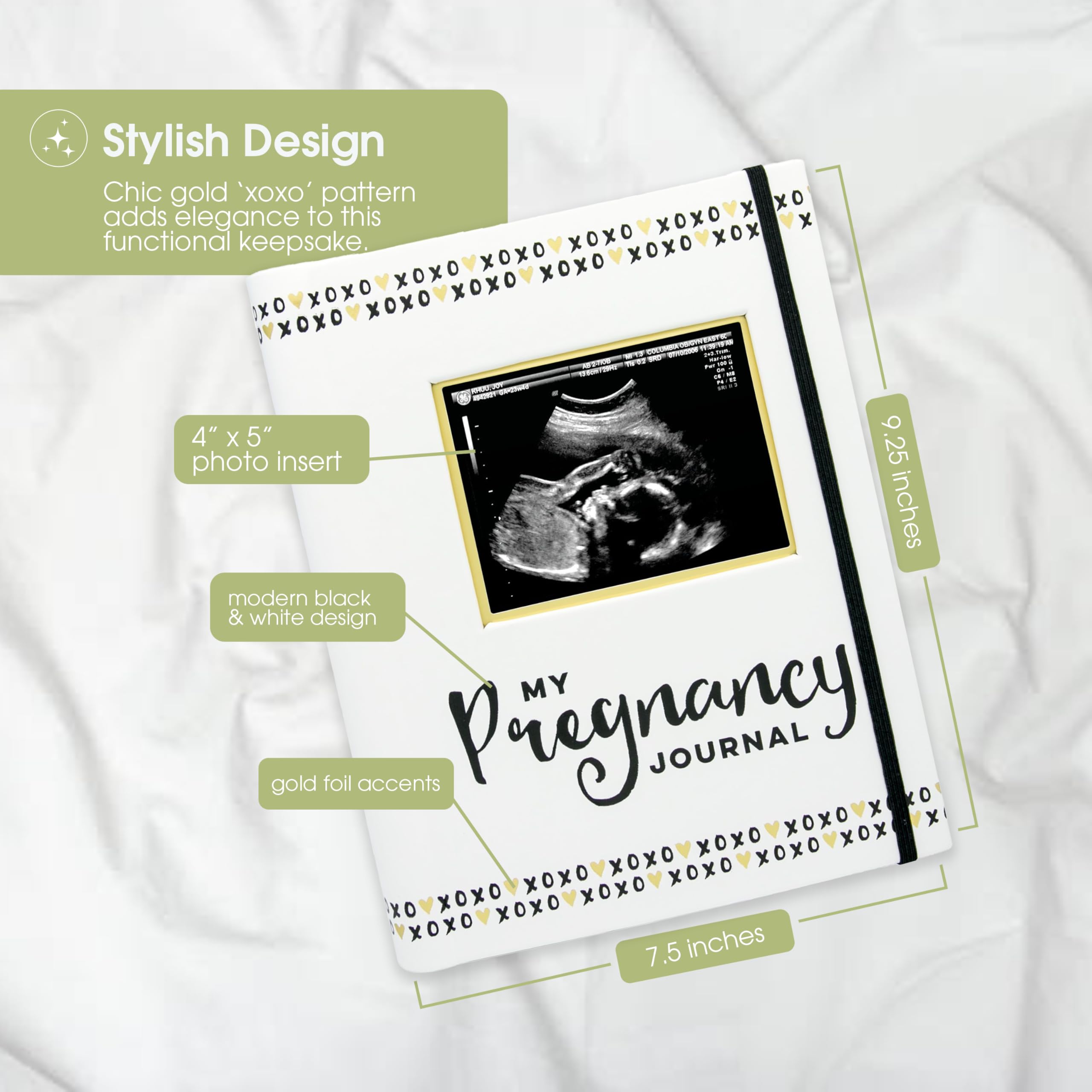 Pearhead My Pregnancy Journal - 74-Page Memory Book and Photo Album, Gender Neutral Planner for Expecting Moms, Includes Milestone Sections and Ultrasound Photo Insert