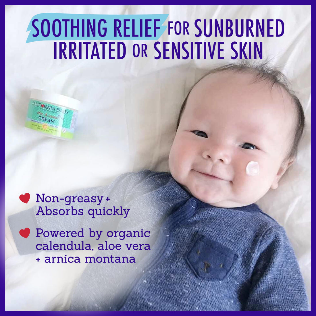 California Baby Aloe & Arnica Cream | Soothing Sunburn Relief Cream | Moisturizes Dry, Irritated Skin | 100% Plant-Based After Sun Lotion | Organic Calendula + Aloe Vera Cream | 57 g / 2 oz.