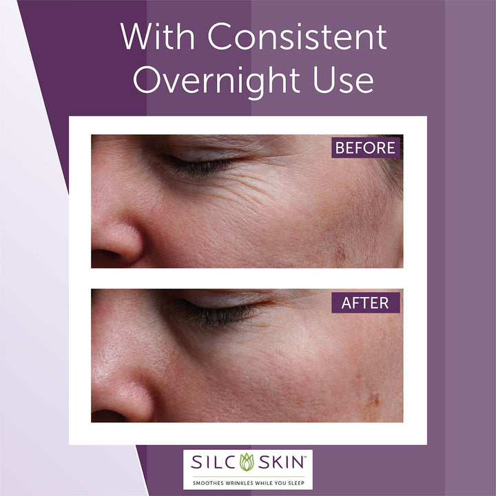 SilcSkin Eye Pad