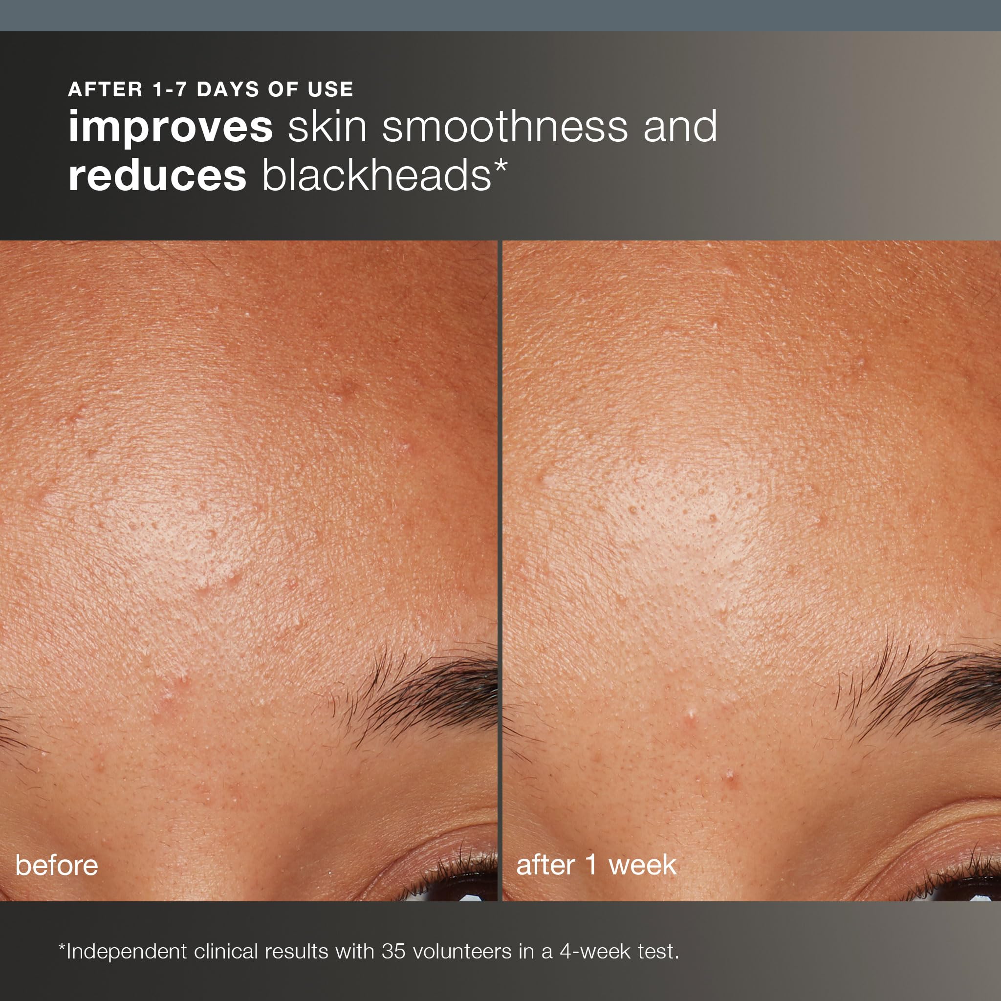 Dermalogica Daily Microfoliant, Face Exfoliator Scrub Powder with Salicylic Acid and Papaya Enzyme, Achieve Brighter, Smoother Skin Daily, 2.6 Oz