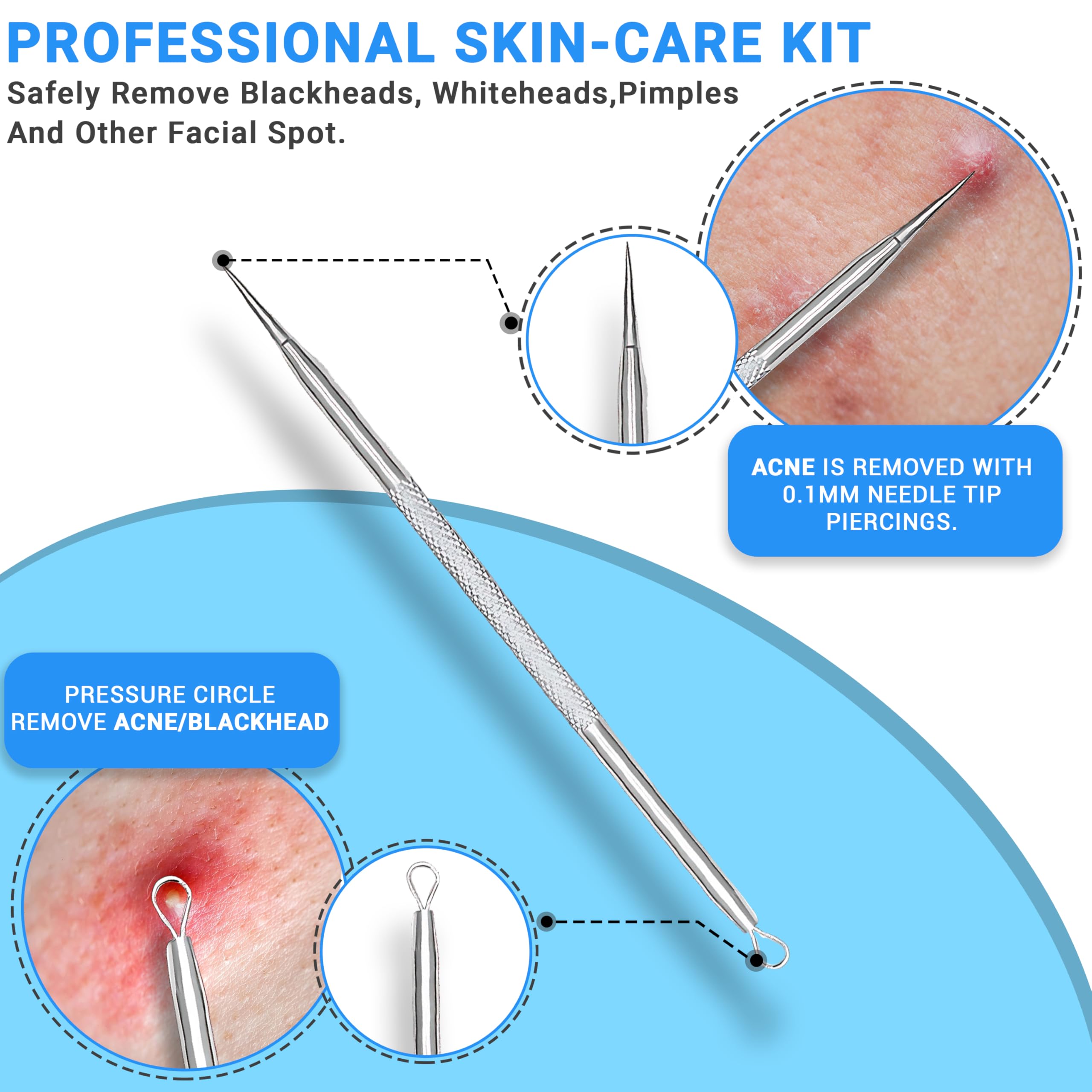 EFAH Care 2Pcs Stainless Steel Pimple Extractor Acne Treatment Tool Surgical Blemish Grade Blackhead Remover Perfect for face and Nose Easy to Clean (Silver)