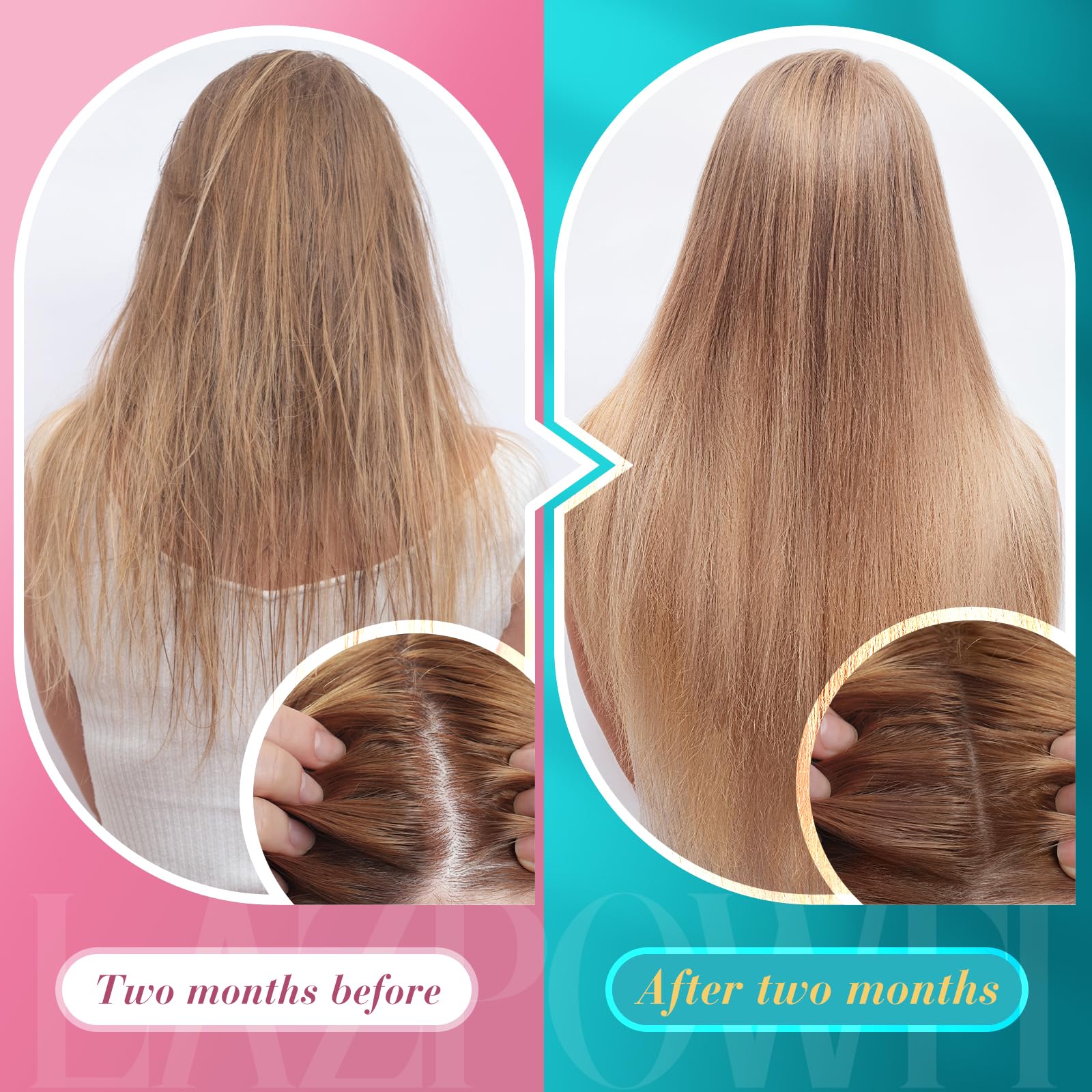 Lazpowfi Biotin Gummies -Hair Skin and Nails Vitamins for Men & Women, Vegan Vitamin B7, Supports Hair Growth and Stronger Nails,60 Day Supply-Raspberry-2 Pack