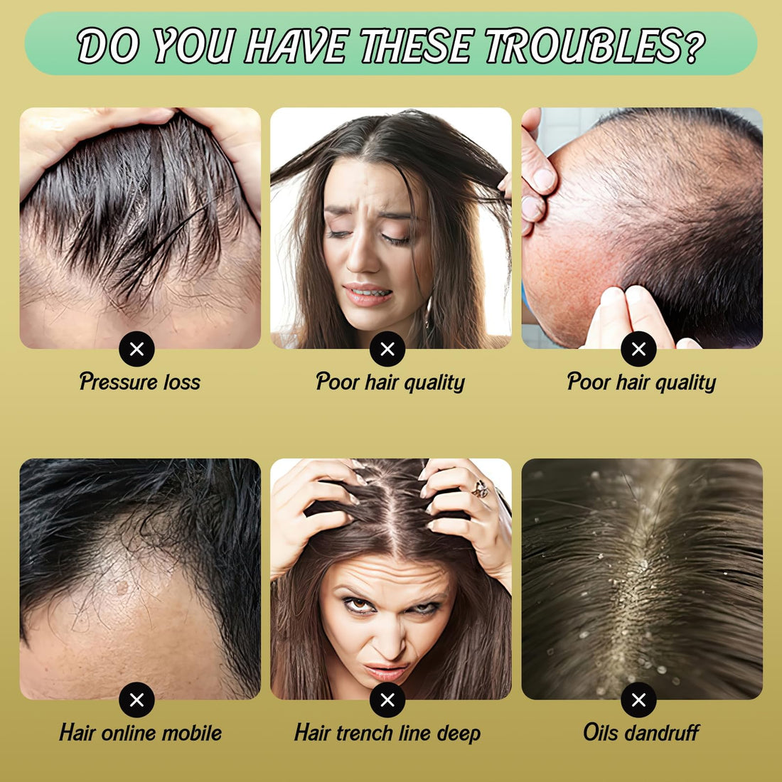 Rednow Ginger Plant Extract Hair Shampoo,Ginger Extract Shampoo,Polygonum Multiflorum Hair Strengthening Shampoo,Hair Care Plant Shampoo,Hair Thickening Shampoo for Women Men (3PCS)