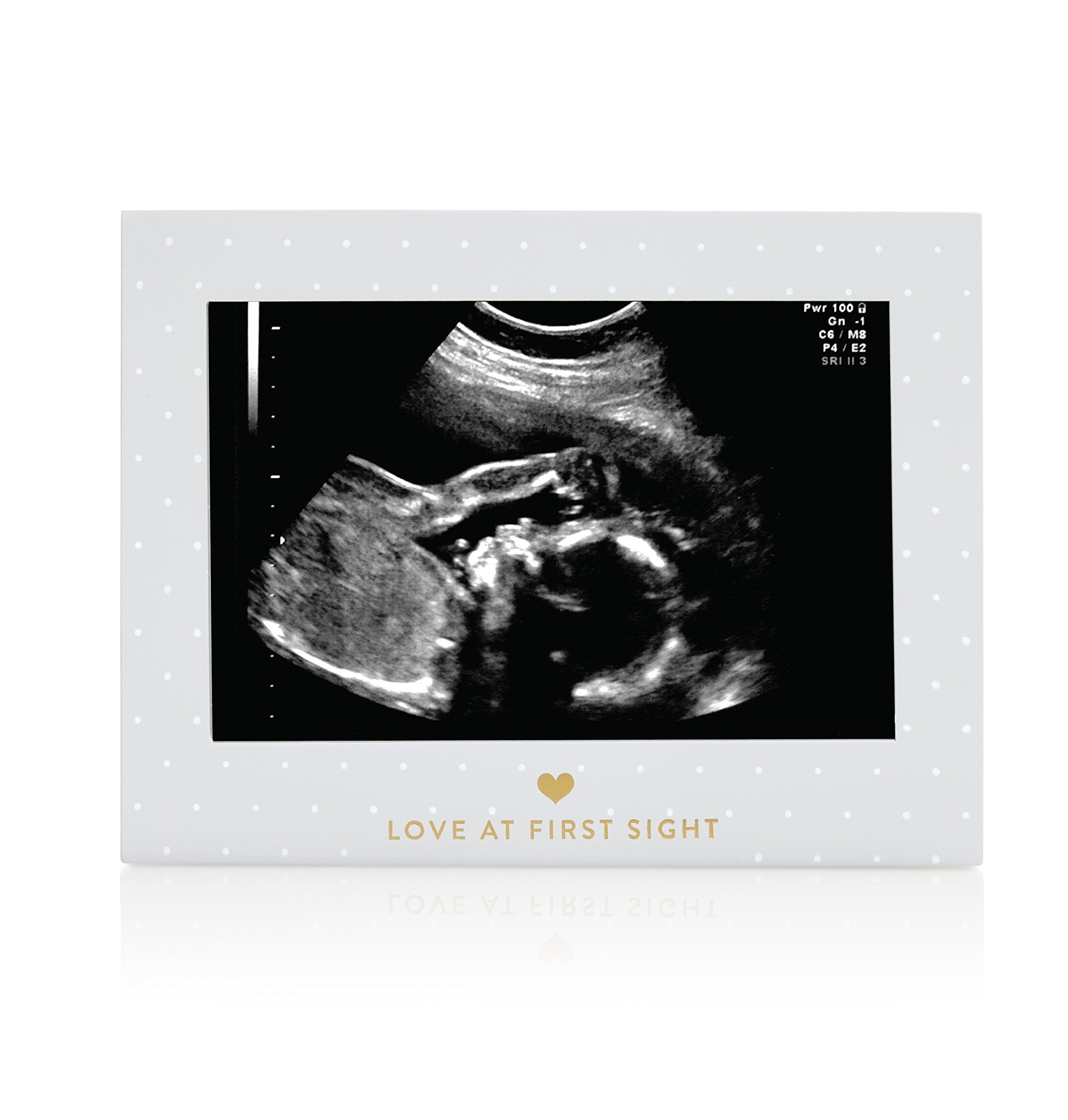 Little Blossoms Pearhead Love At First Sight Sonogram Picture Frame, Ultraound Pregnancy Keepsake, Gender-Neutral Nursery Décor For Baby Girl or Baby Boy, Polka Dot, 6.94x5.25x.75 Inch (Pack of 1)