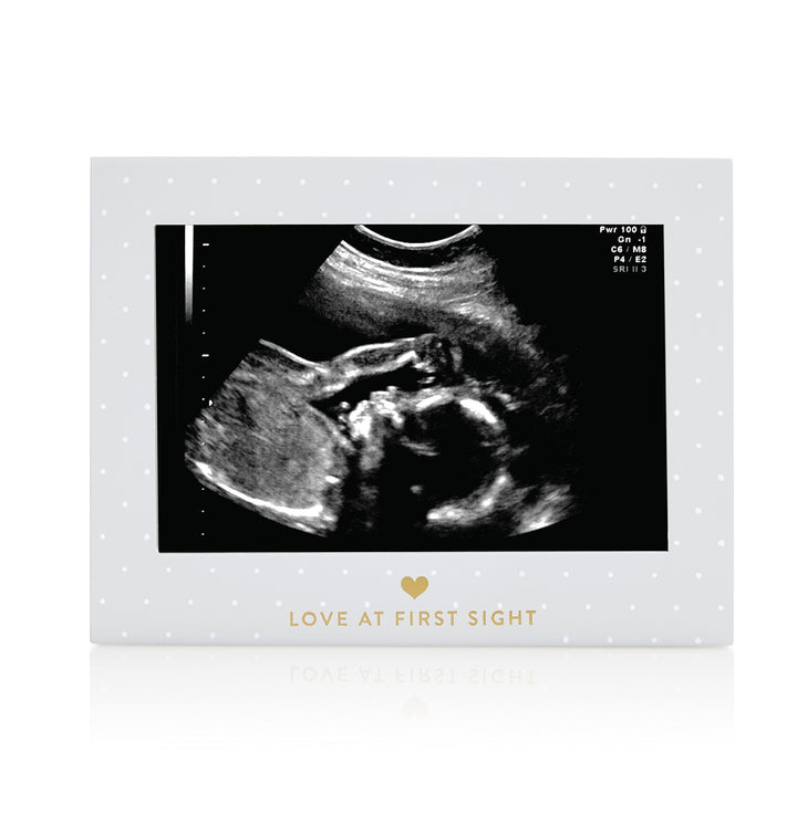 Little Blossoms Pearhead Love At First Sight Sonogram Picture Frame, Ultraound Pregnancy Keepsake, Gender-Neutral Nursery Décor For Baby Girl or Baby Boy, Polka Dot, 6.94x5.25x.75 Inch (Pack of 1)