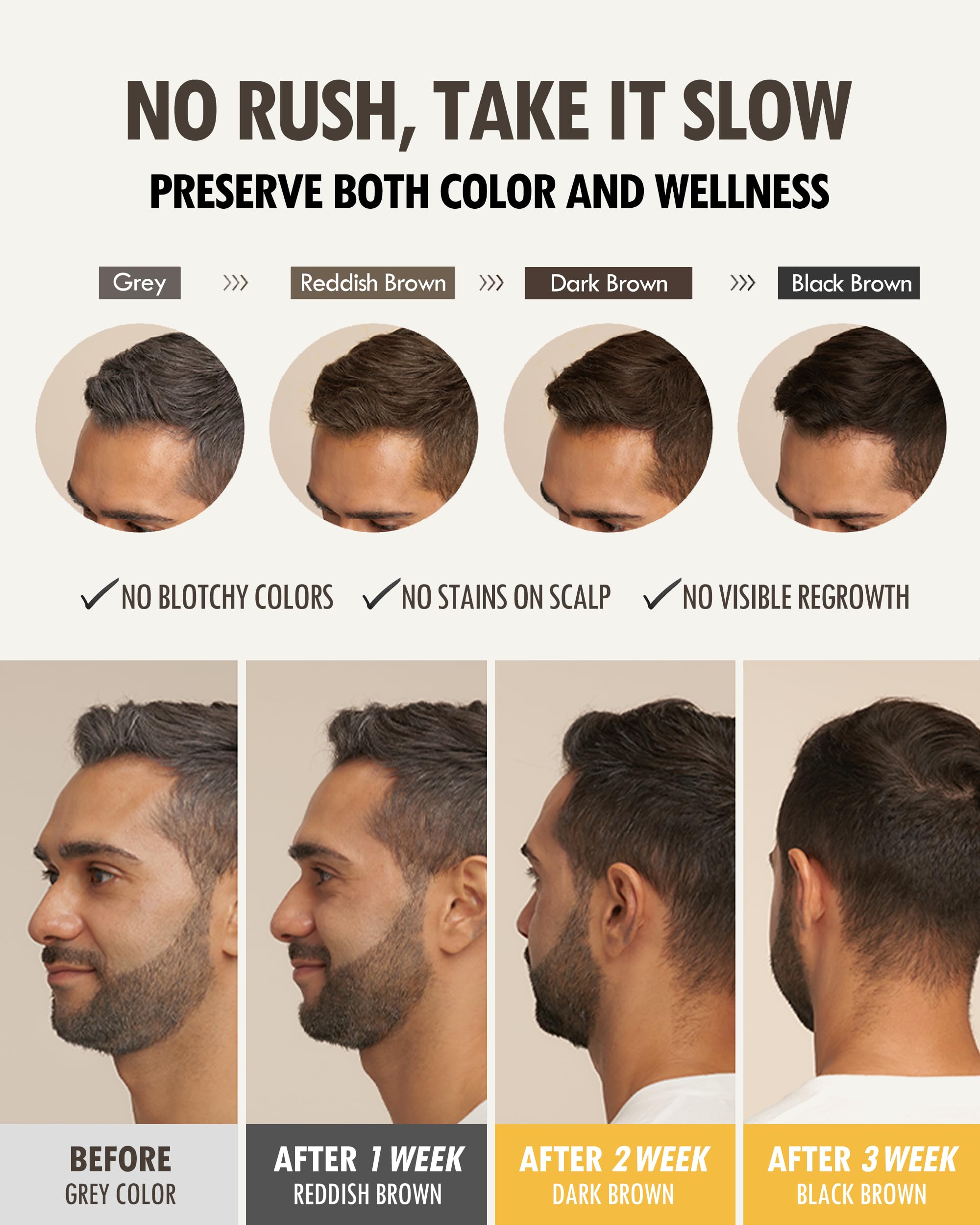 MODA MODA Zero Gray Black Hair Shampoo (10.58 Oz) | Natural Darkening Color for Hair & Scalp | Age-Defying, Volumizing Formula that Reduces Hair Breakage