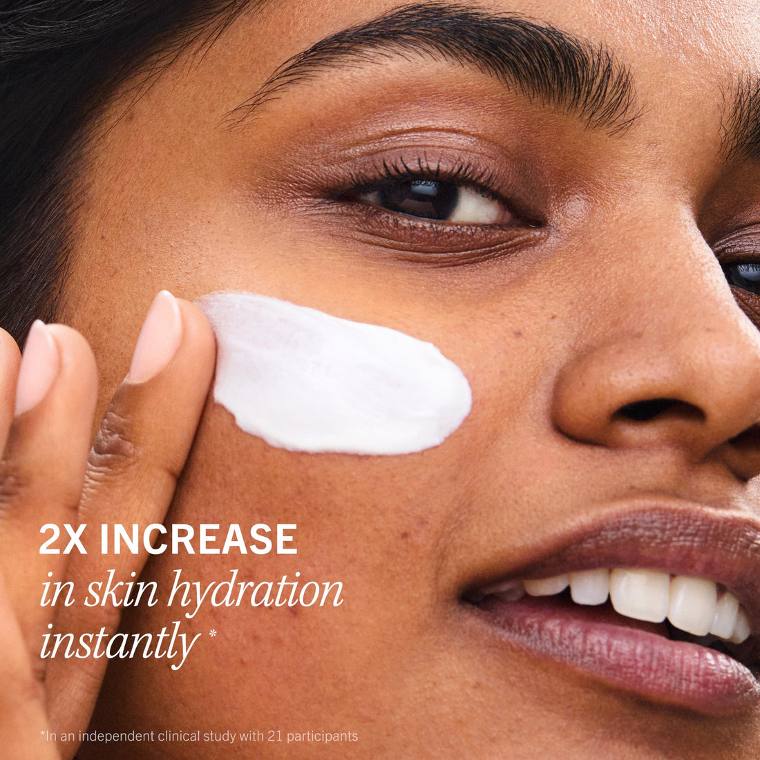 First Aid Beauty Ultra Repair Cream Intense Hydration Moisturiser for Face and Body – Rich Whipped Texture For Immediate Skin Hydration, 170.1g