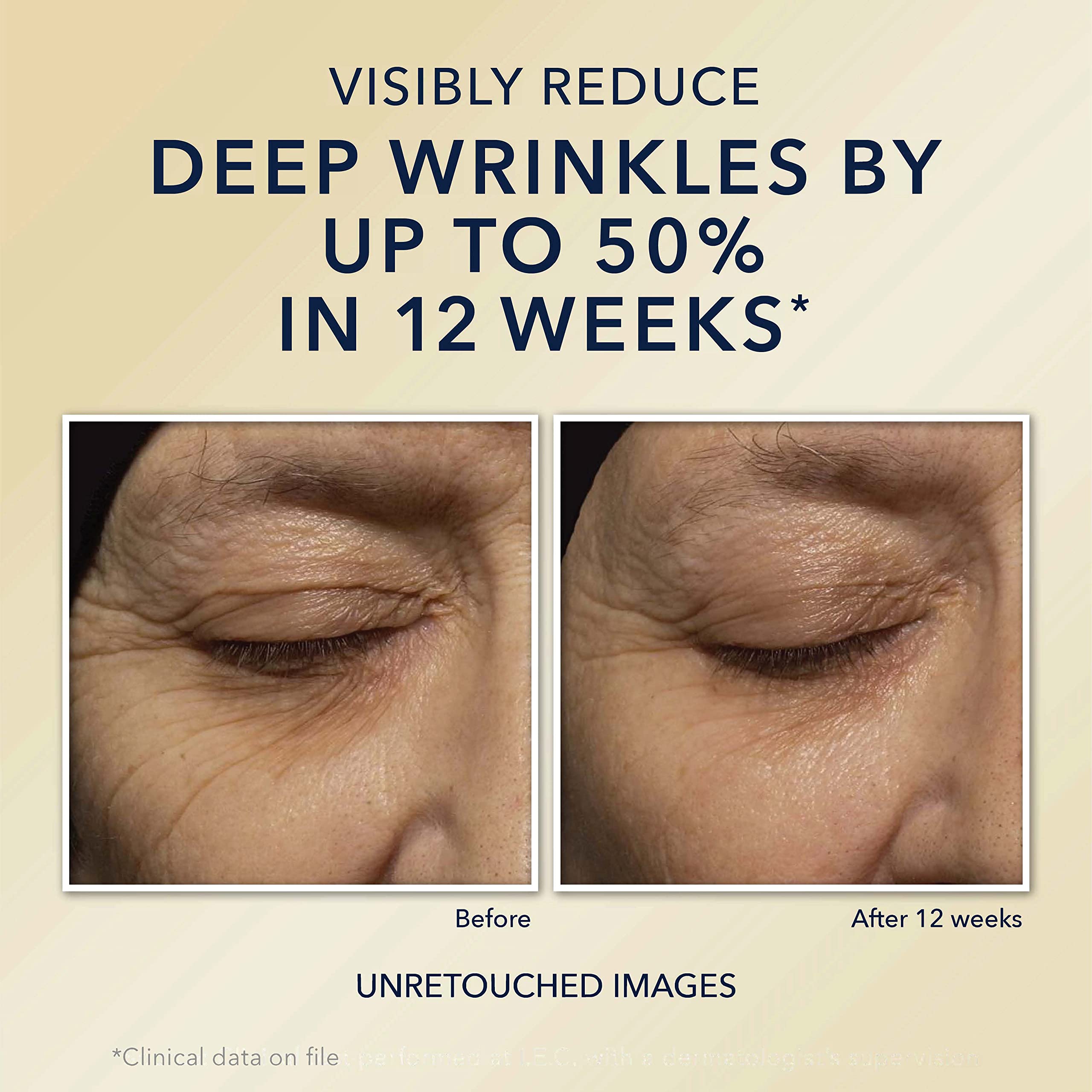 RoC Retinol Correxion Deep Wrinkle Anti-Aging Night Cream, Daily Face Moisturizer with Shea Butter, Glycolic Acid and Squalane, Stocking Stuffers for Men & Women, 1 Ounces (Packaging May Vary)