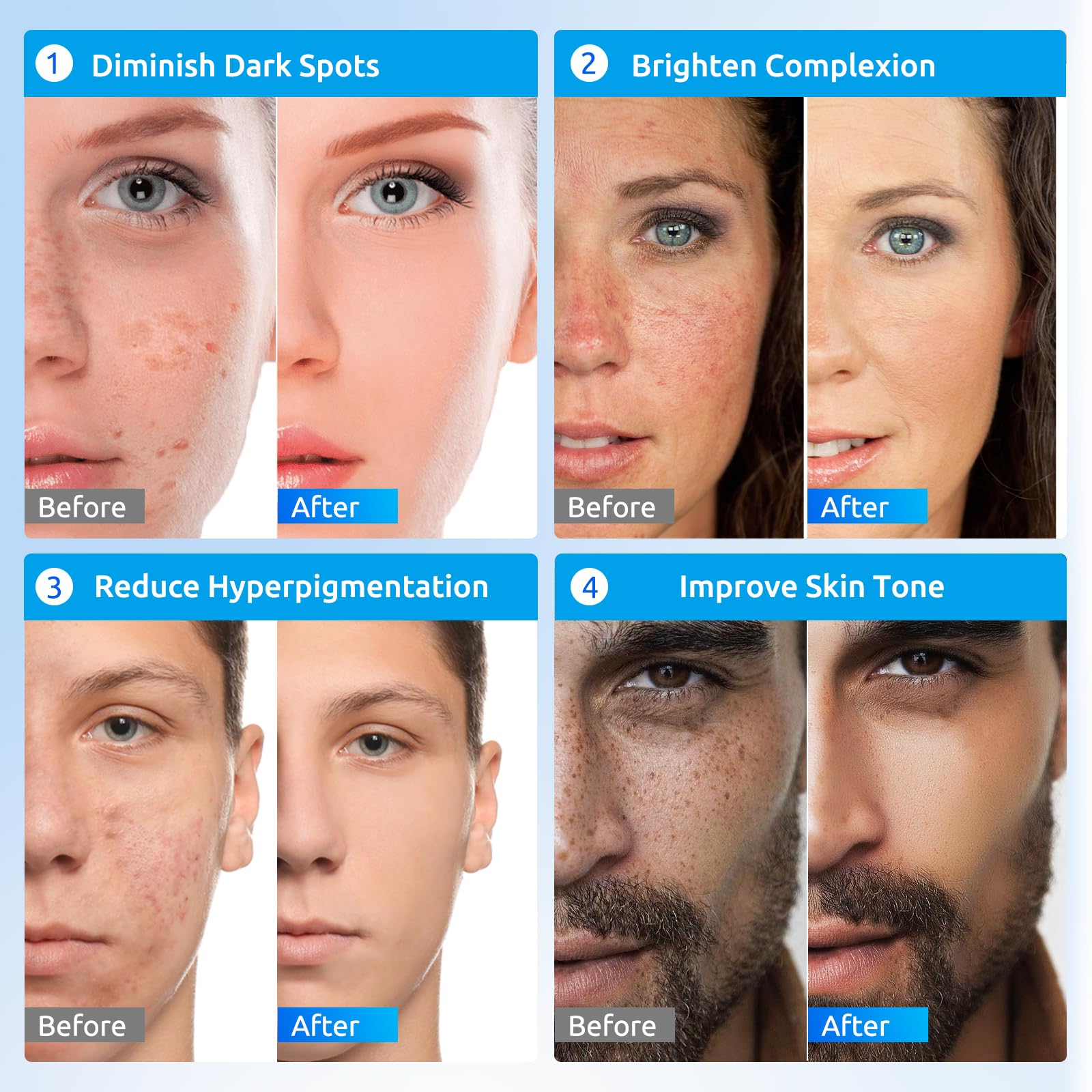 HANYWIL Dark Spot Remover for Face Cream, Dark Spot Corrector, Rapid Tone Repair Retinol, Skin Brown Spot Remover, Skin Care Face Cream, Sun Spot Remover, Age Spot Corrector for Women Men (2 Fl Oz)