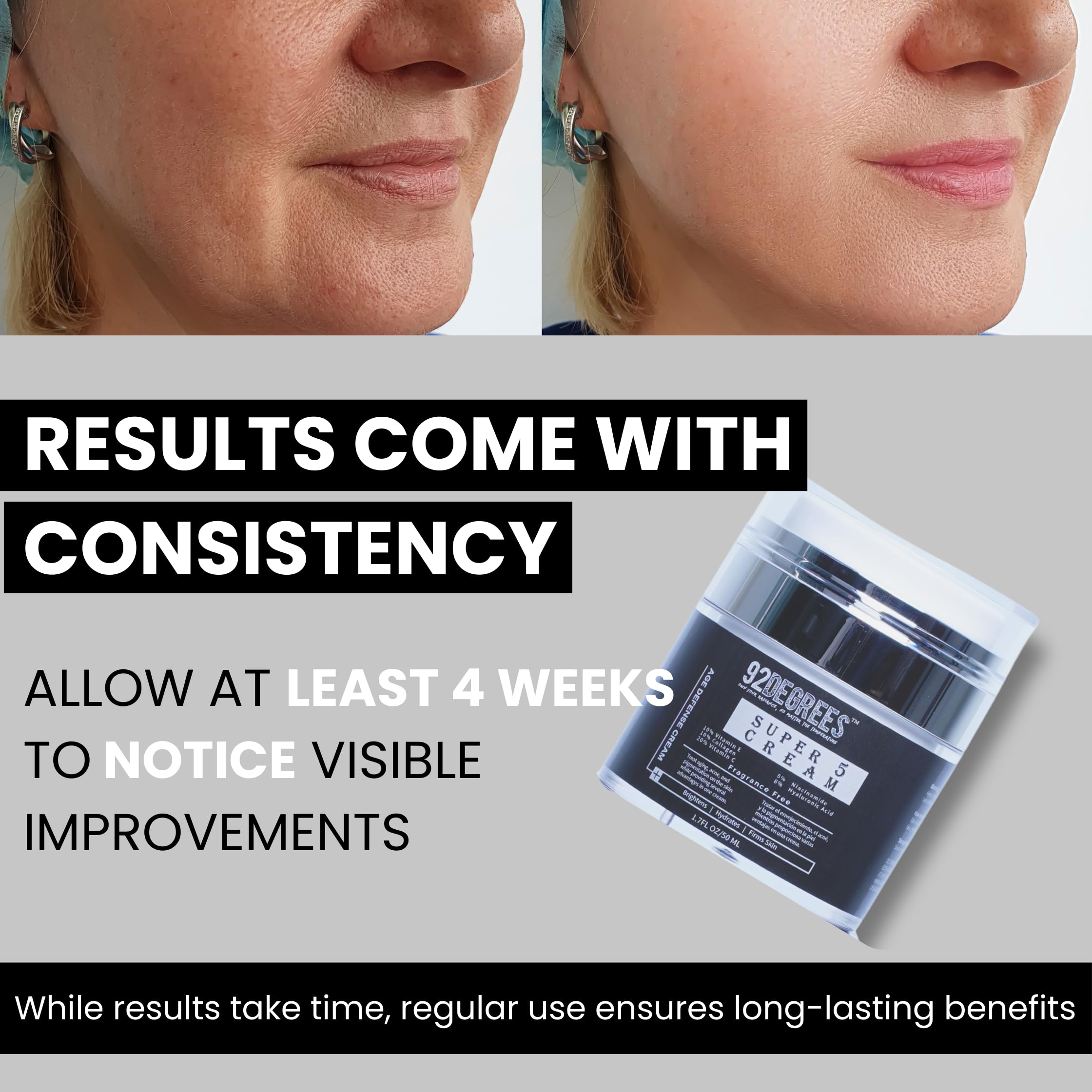 92 Degrees Super 5 Anti-Aging Face Cream, 1.7 Fl Oz, with Vitamin C, Hyaluronic Acid, Collagen, Niacinamide, Fragrance Free