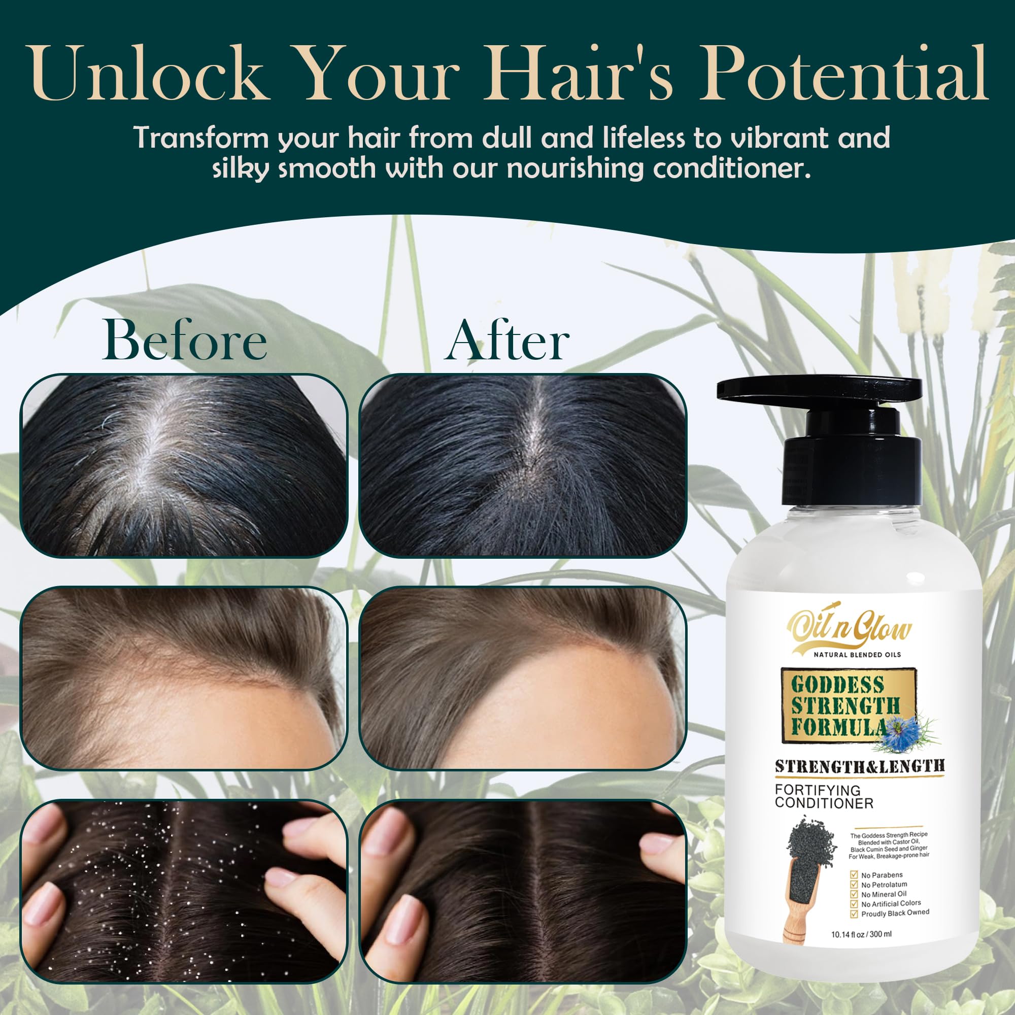 Natural Hair Growth Conditioner with Black Cumin Seeds: Strengthening & Moisturizing Hair Conditioner For Hair Loss, Damaged, Dry, Frizzy & Thinning Hair 10 Fl. Oz - Fragrance Free