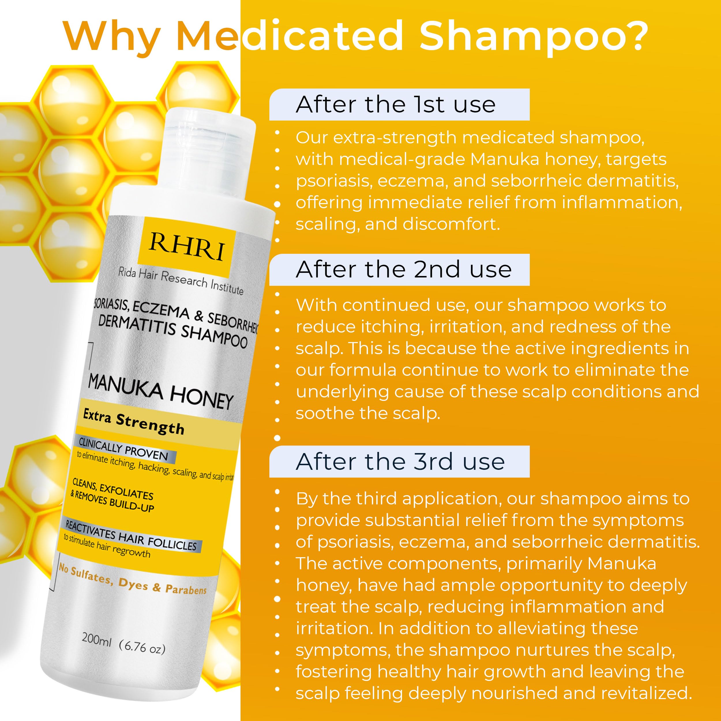 Psoriasis Shampoo for Men & Women with Manuka Honey | Best Itchy Scalp Treatment for Eczema, Seborrheic Dermatitis, Ringworm & Folliculitis Scalp Treatment