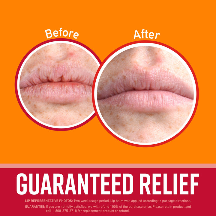 O'Keeffe's Lip Repair Lip Balm with Cherry & Vitamin E Oil - Stick (3 Pack) - Moisturizer for Extremely Cracked, Dry Lips