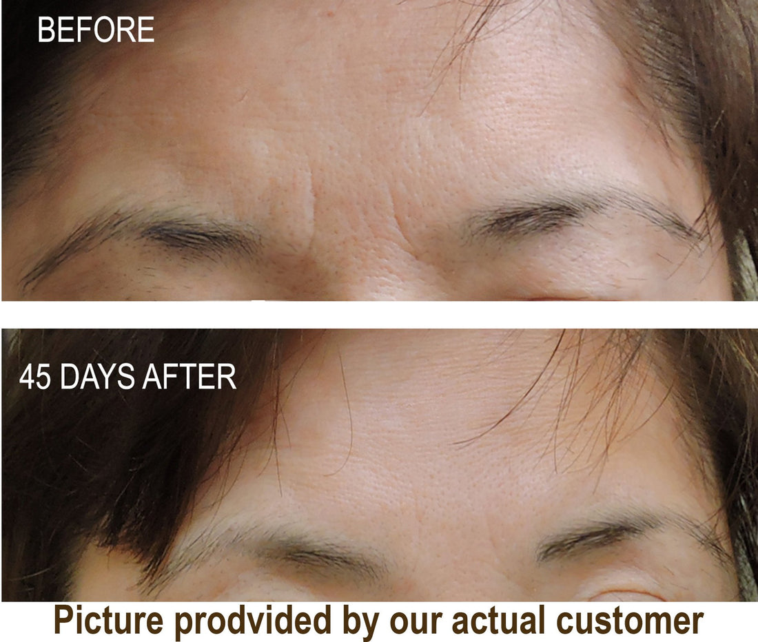 DNA Code-No Needle Alternative-Argireline Copper Peptide Wrinkle Reduce Serum Booster w/Snap-8, Matrixyl 3000