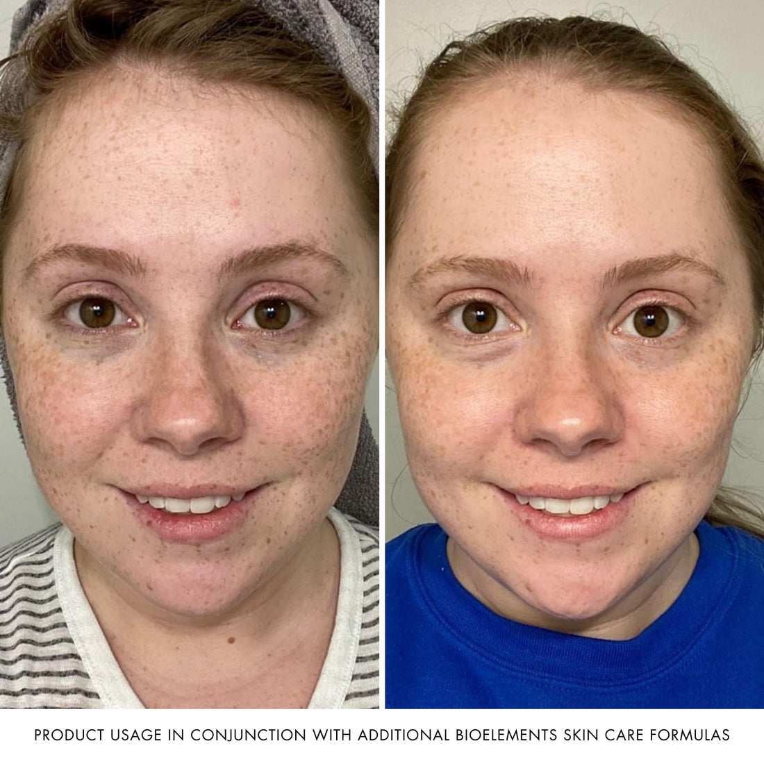 Bioelements Quick Refiner for Eyes, 0.5 fl. oz.