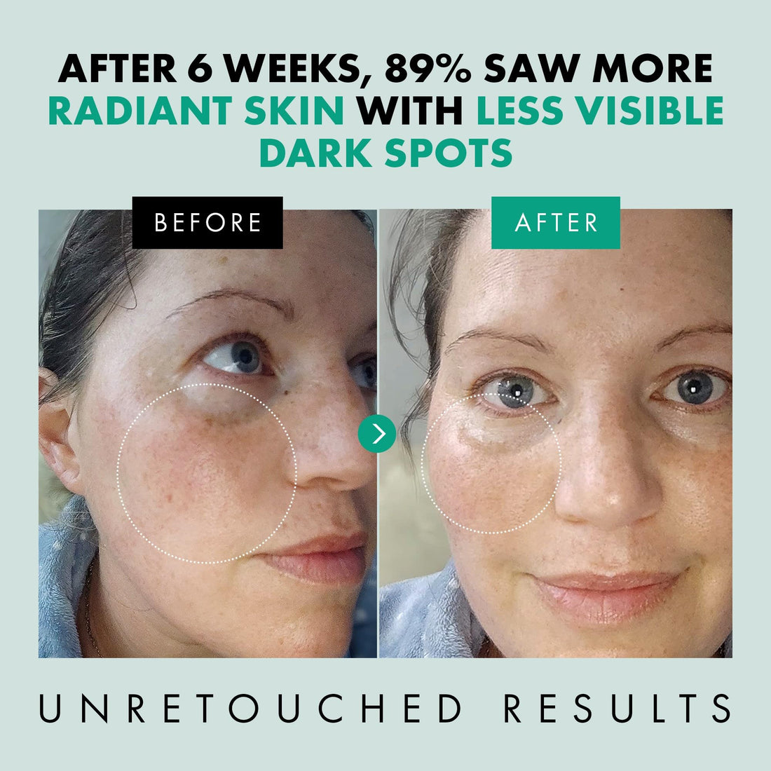 Eclat Skincare Niacinamide Serum - Pore Minimizer for Uneven Complexion - Brightening Niacinamide Serum for Face - Lightening & Moisturizing Skin Care for Dark Spots 1 fl oz