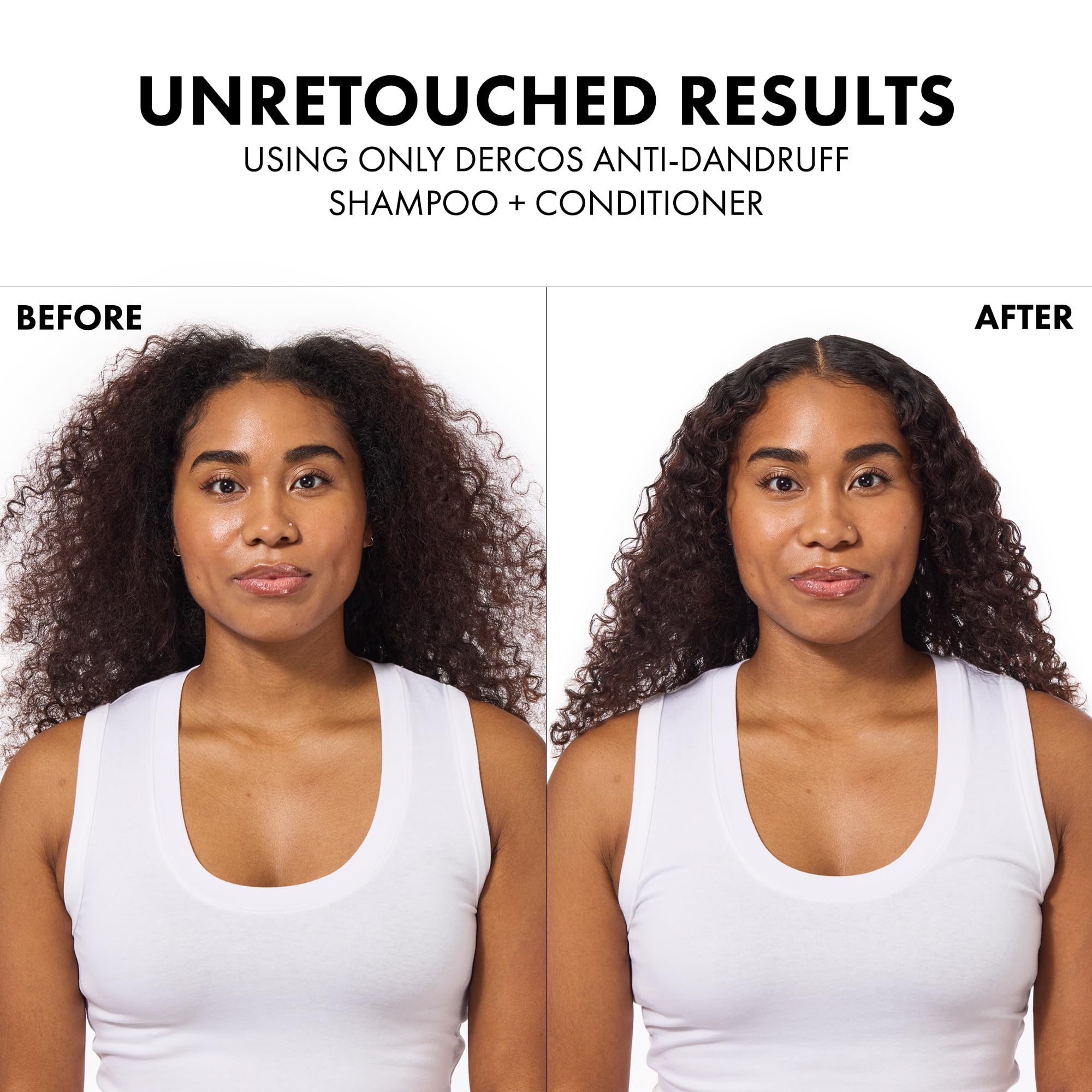 Dercos Hair & Scalp Moisturizing Conditioner, Formulated With Glycerin, Niacinamide + Hyaluronic Acid, Hair Conditioner & Scalp Moisturizer, Strengthens, Post Dandruff Treatment, 6.7 Fl Oz