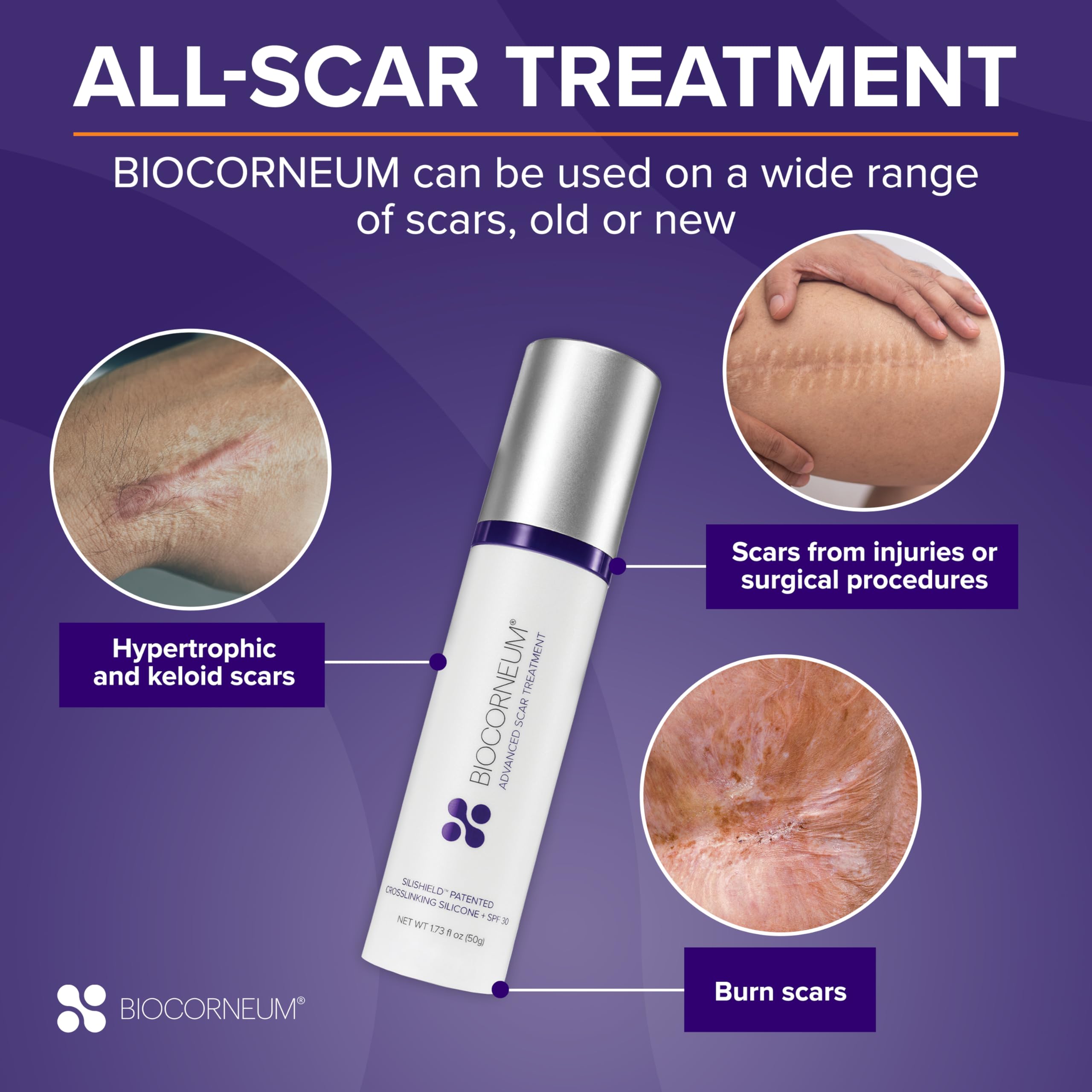 bioCorneum Plus SPF 30 Advanced Scar Supervision (Size 10 gram)