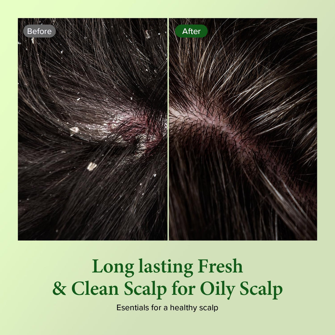 KUNDAL Tea Tree & Macadamia Deep Cleansing Shampoo [Jasmine Woody] - Korean Hair Care, Scalp Care, Tea Tree extract, For All hair Types 10.14fl oz (pack of 1)