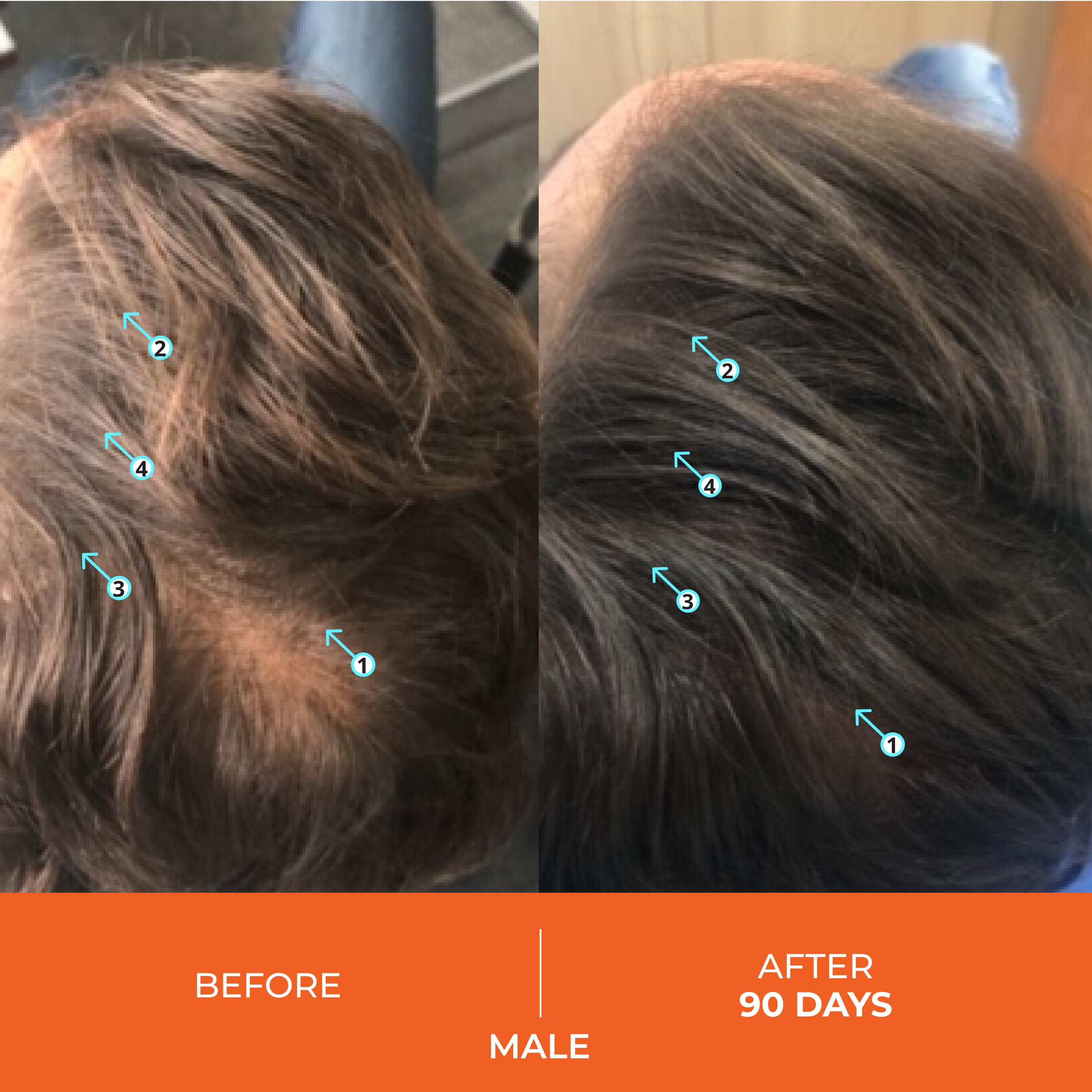 DS Laboratories Revita Stimulating Shampoo,180ml 'Pack of 2'