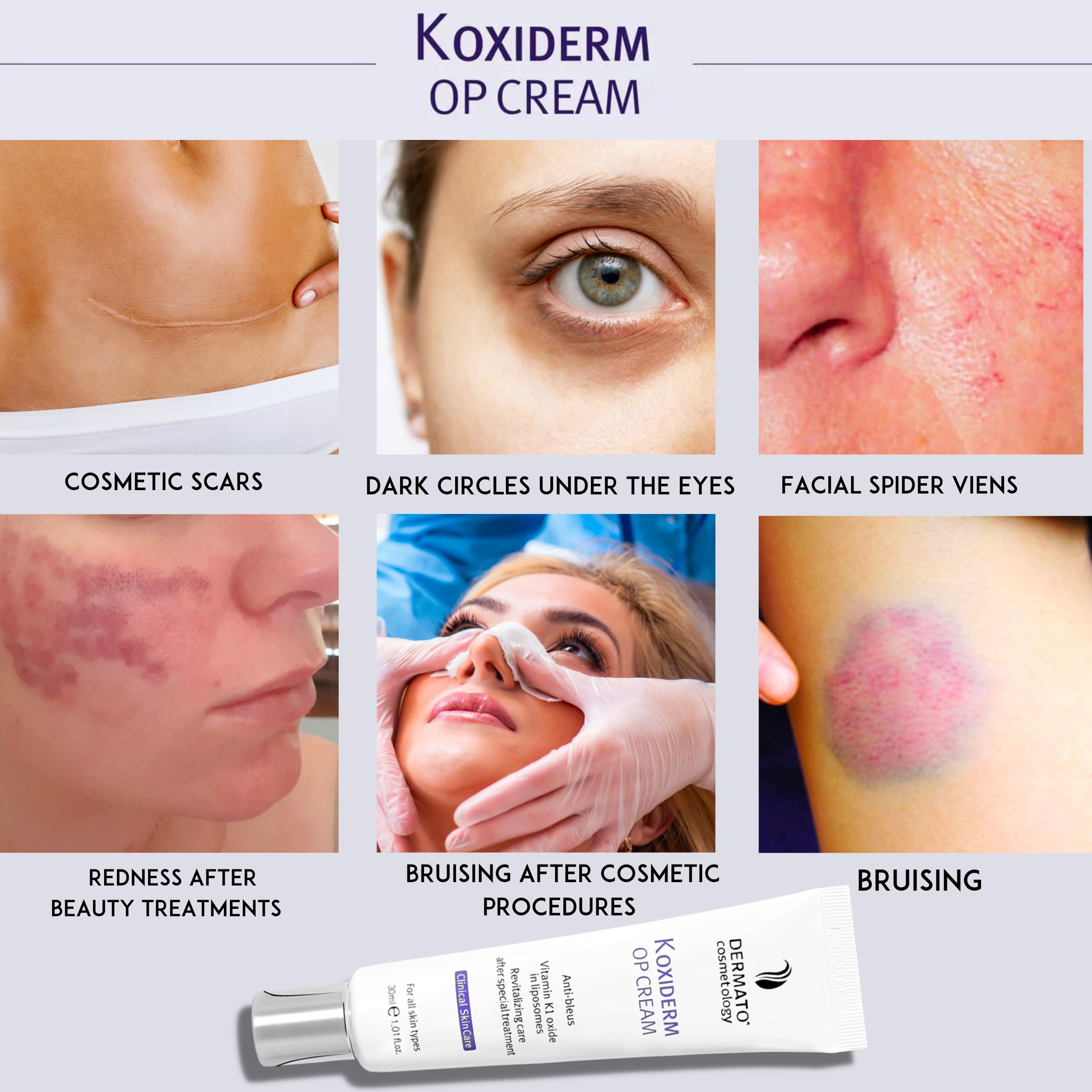 Vitamin K1 Cream, Minimizing Appearance of Scars, Dark Eye Circles, Bruises, Varicose Veins, Purpura and Redness 1.01Oz by dermato