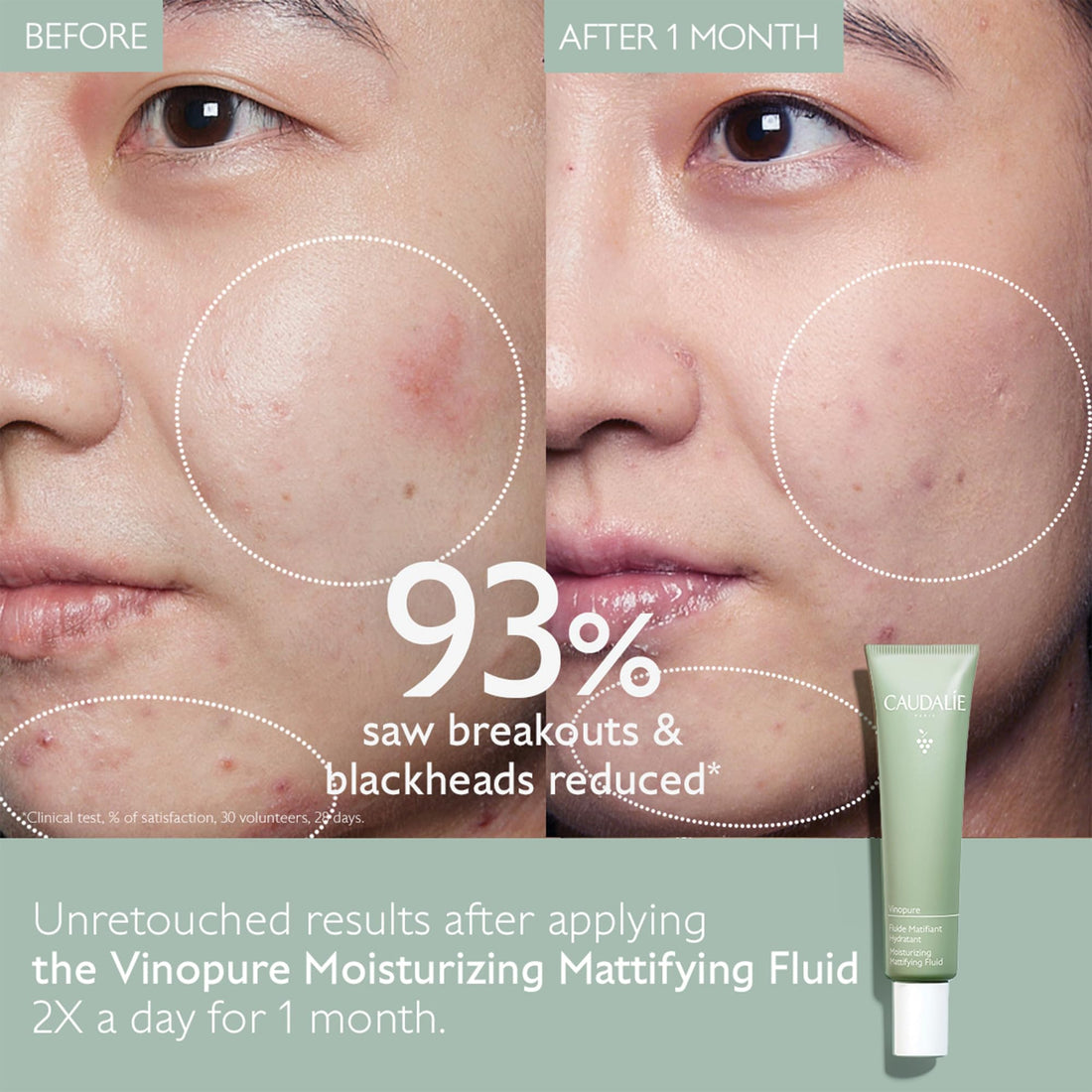 Caudalie Vinopure Oil Control Moisturizer for Acne Prone Skin, Hydrating & Mattifying Moisturizer, 1.35 Fl Oz