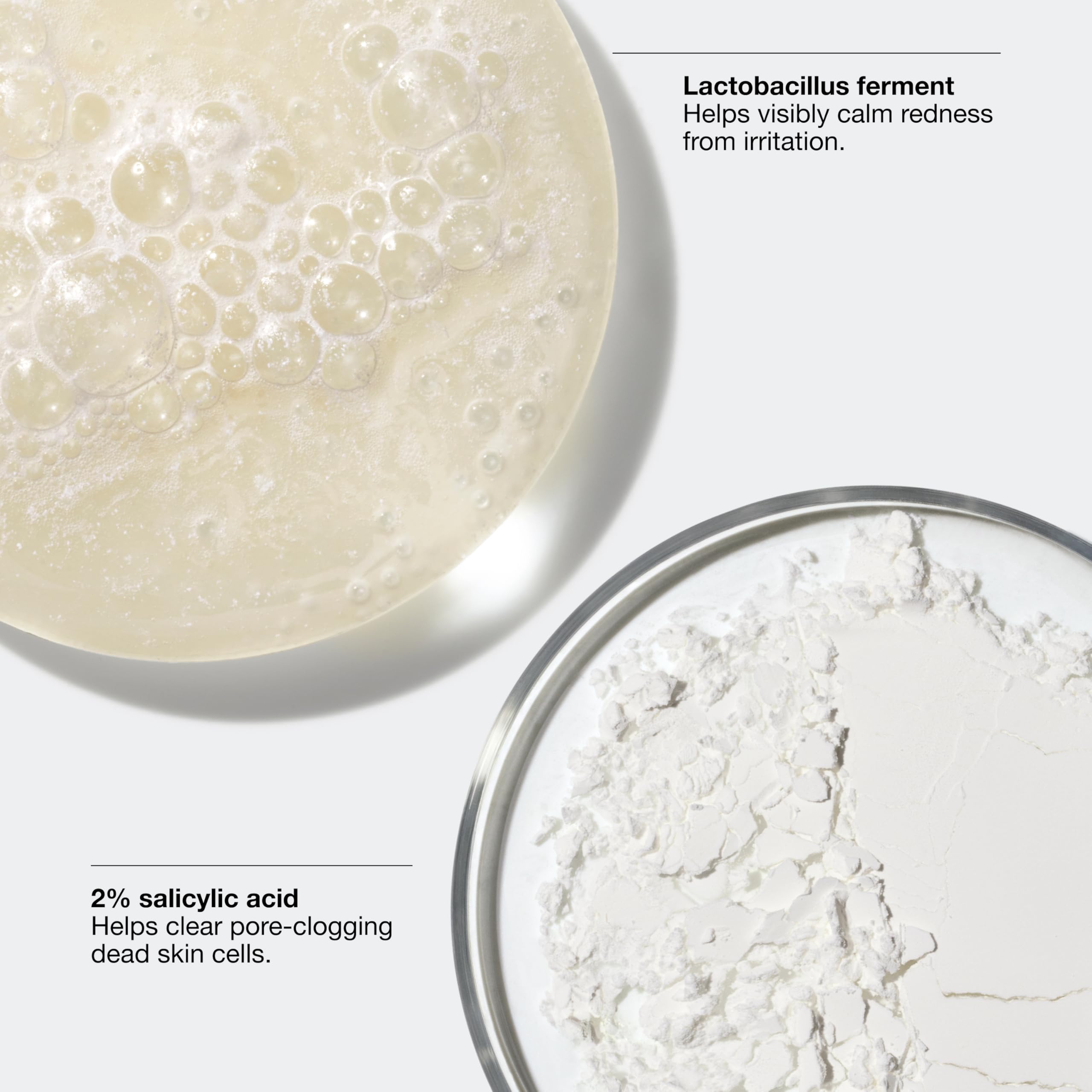 Clinique Acne Solutions Clinical Clearing Gel Acne Treatment With Witch Hazel + Salicylic Acid For Very Dry to Oily Skin Types | Oil-Free | Soothing, 0.68 Fl Oz