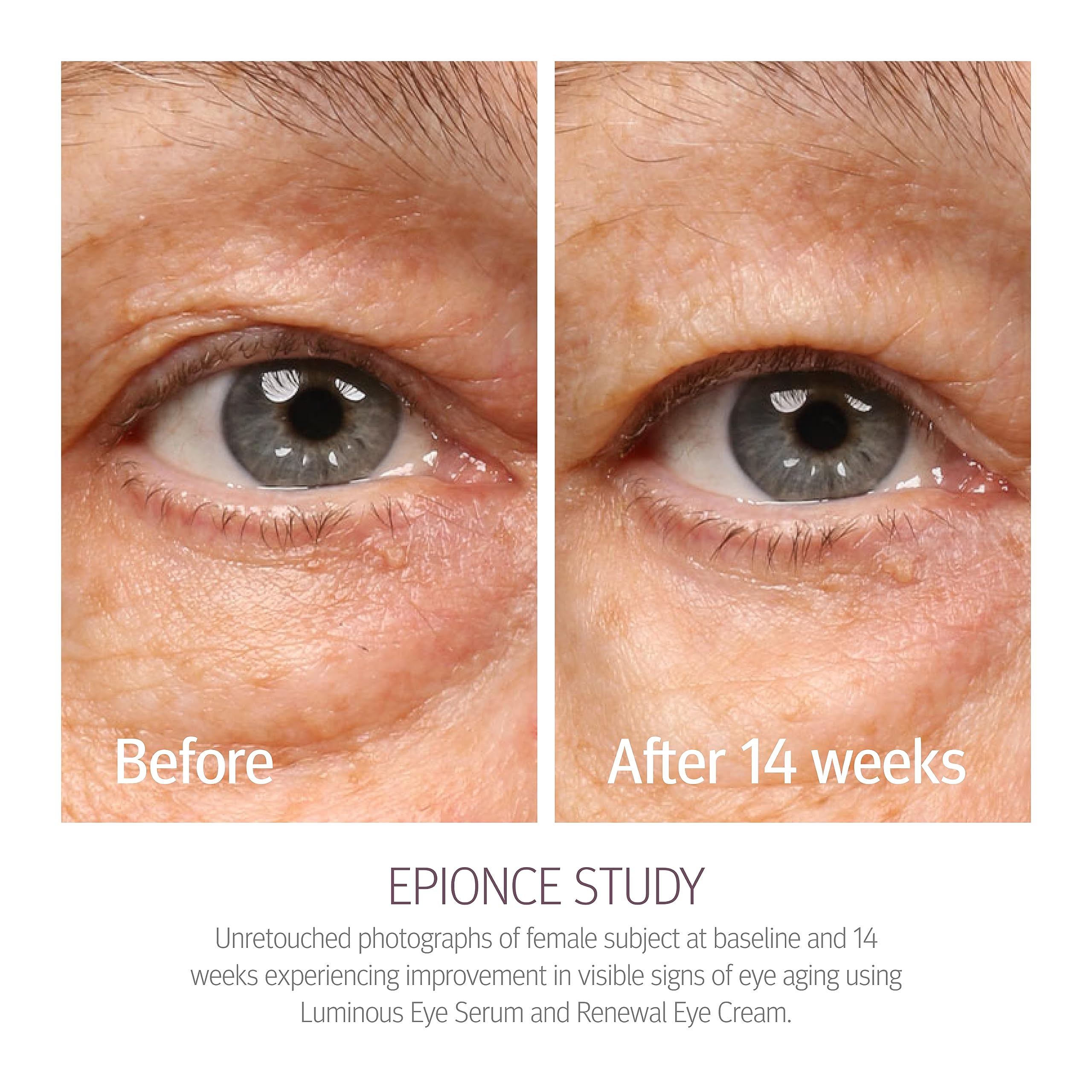 Epionce Renewal Eye Cream, 0.53 Fluid Ounce