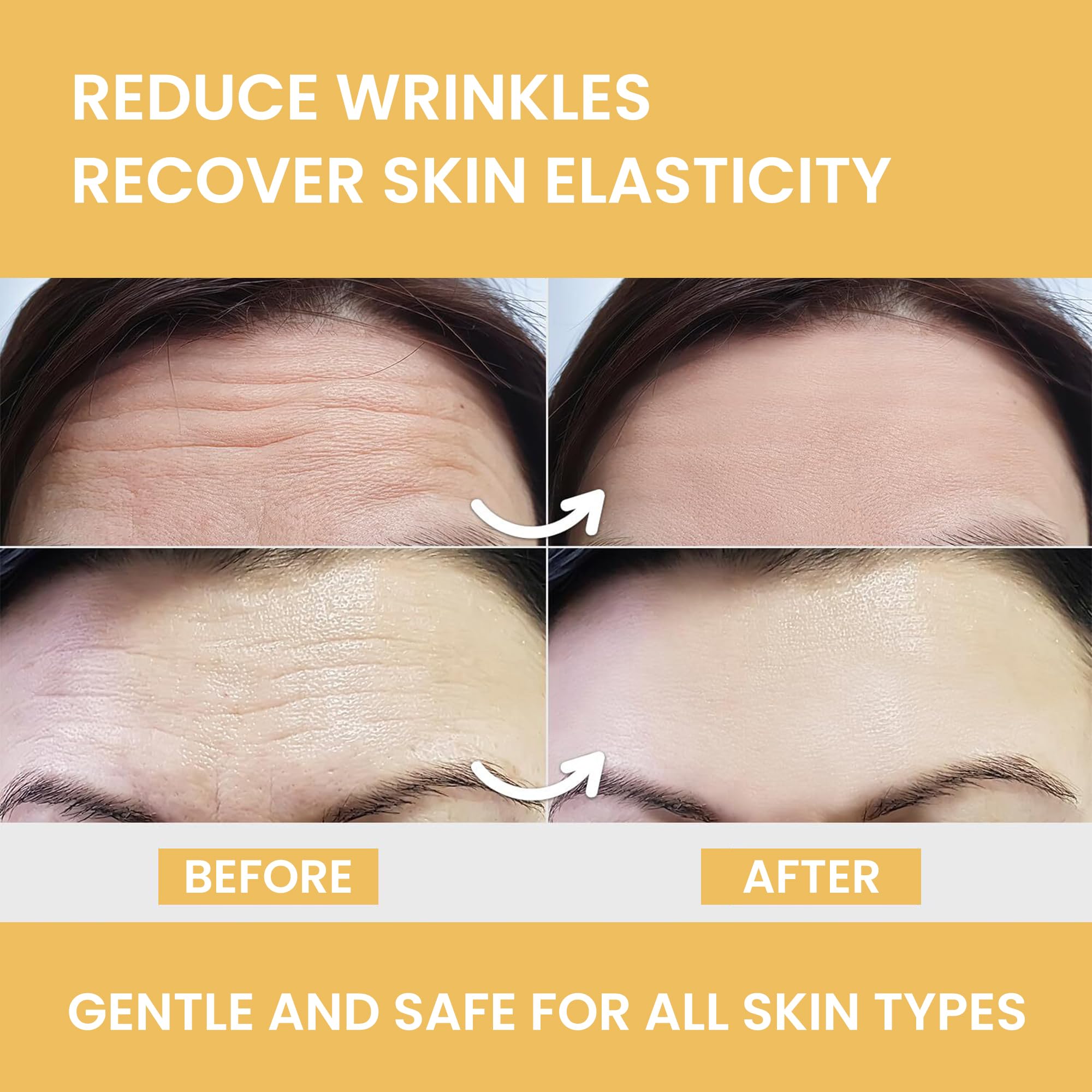 MONIER Forehead Wrinkle Patches Smoothing Overnight - Anti Wrinkle Patches for Face and Forehead Fine Lines & Frown Lines - With Aloe, Collagen, Vitamin E, Hyaluronic Acid | 12 pcs