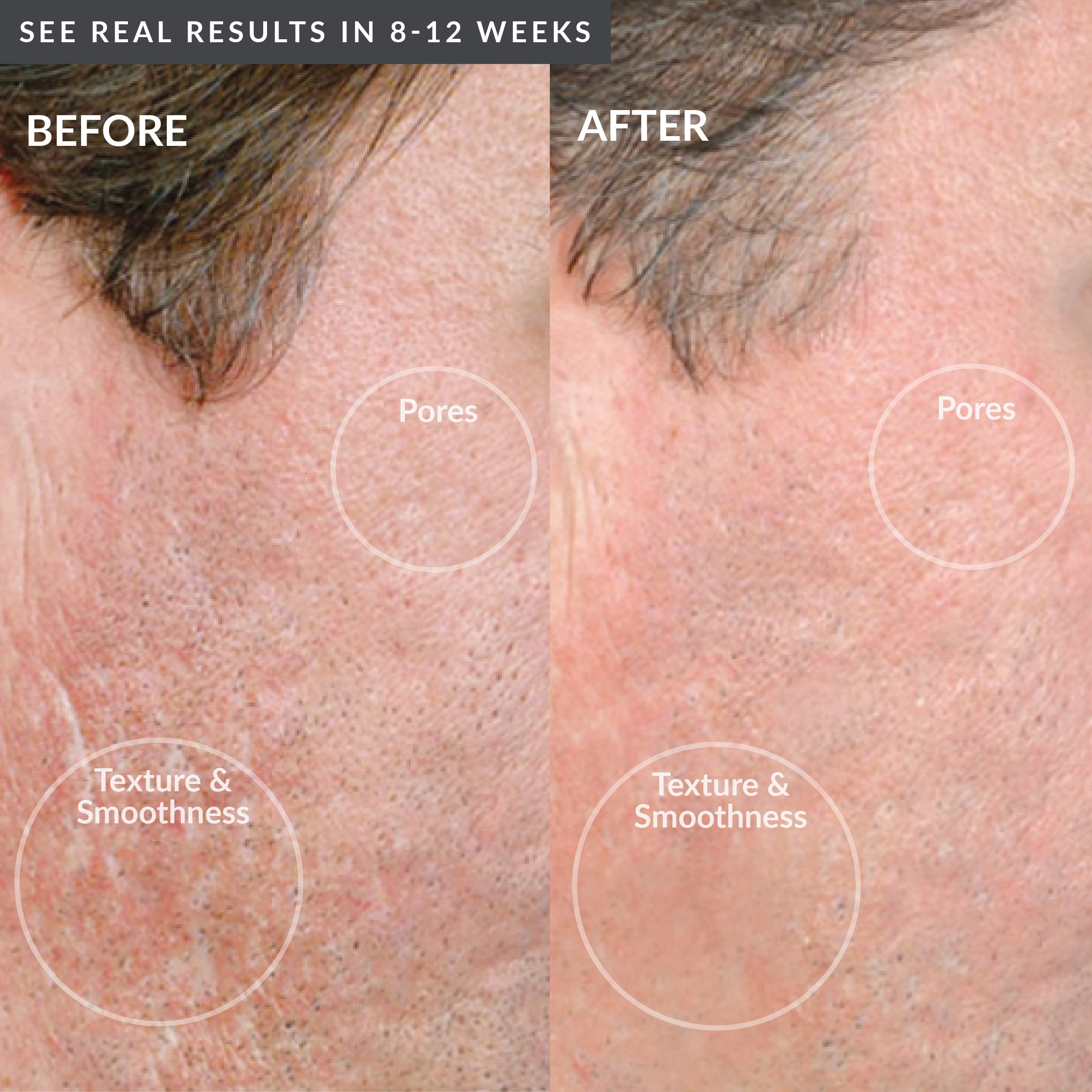 PMD Personal Microderm Man