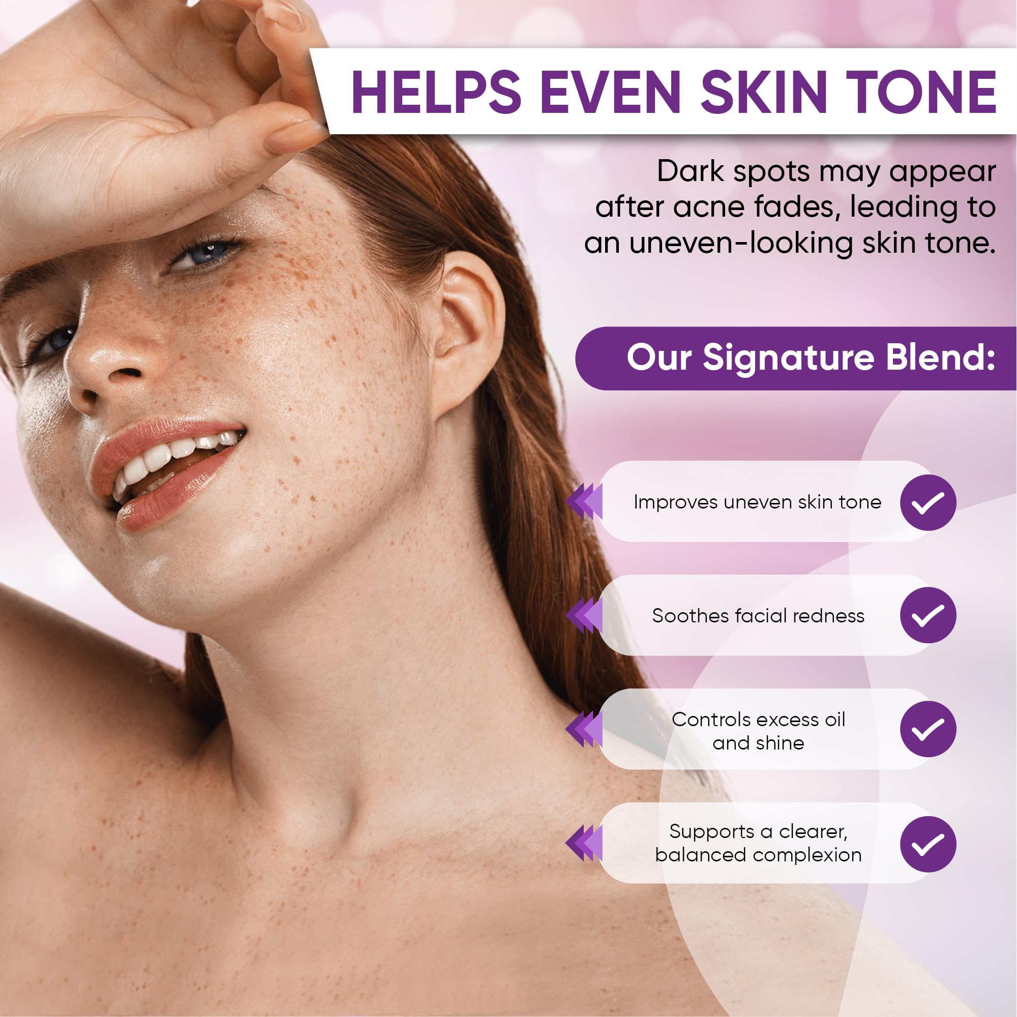 AOBBIY Azelaic Acid Acne Cream: Azelaic Acid For Face - Premium Azelaic Acid Cream - Face Skin and Beauty Care - Azelaic Acid Facial Cream, 1 Oz